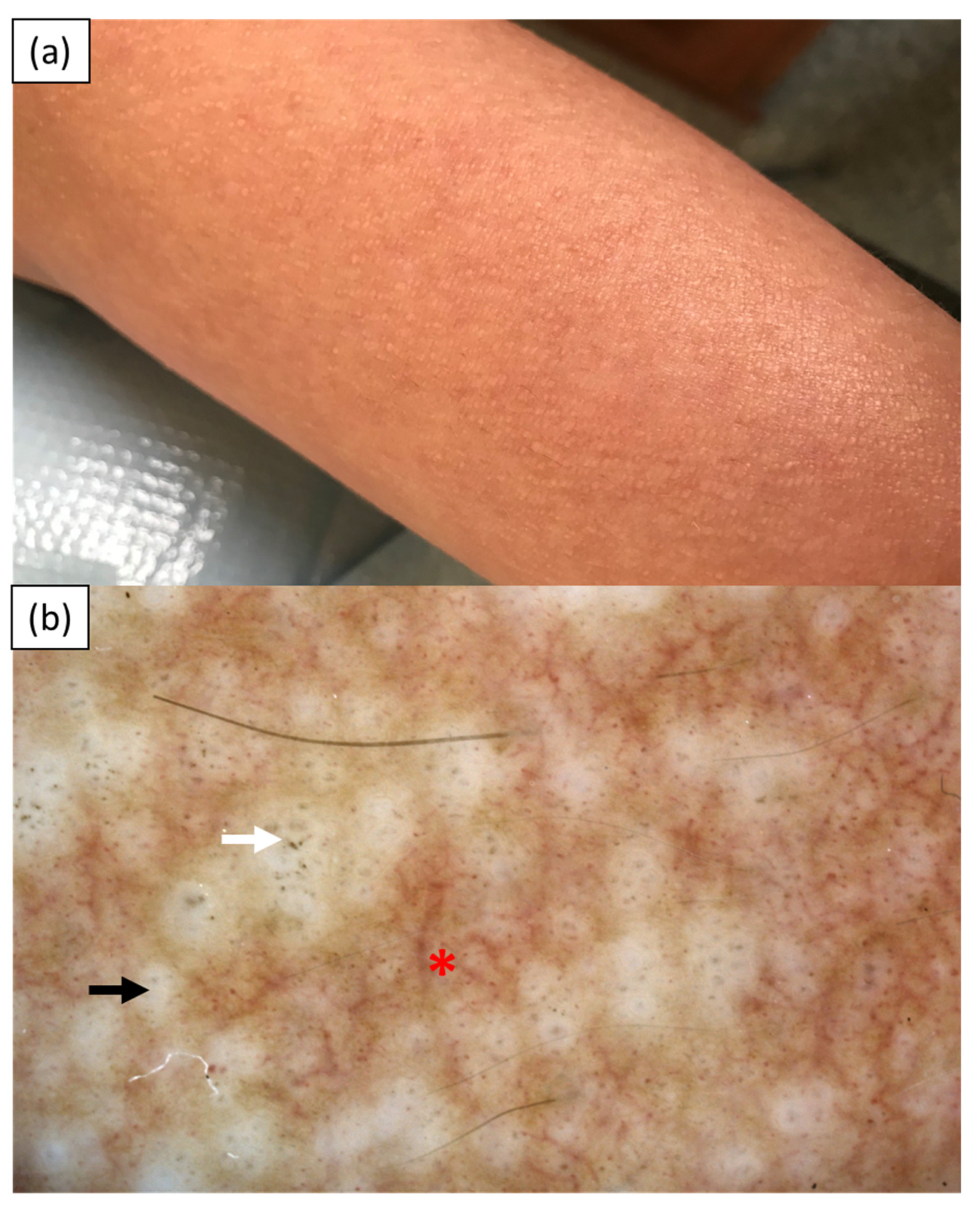 Medicina 57 01027 g003