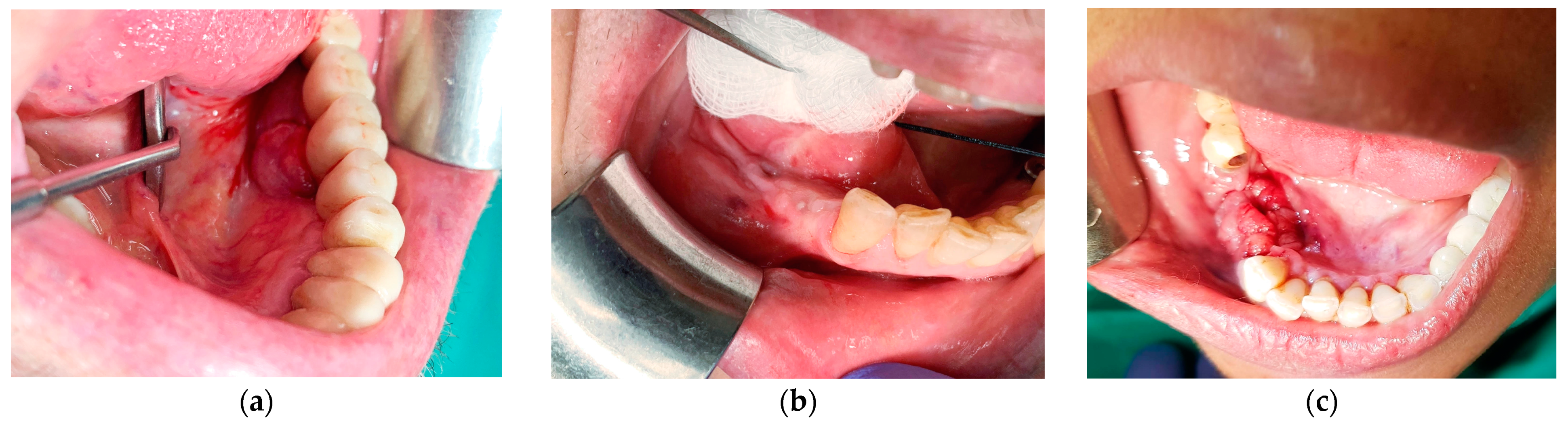 Medicina 57 01069 g001