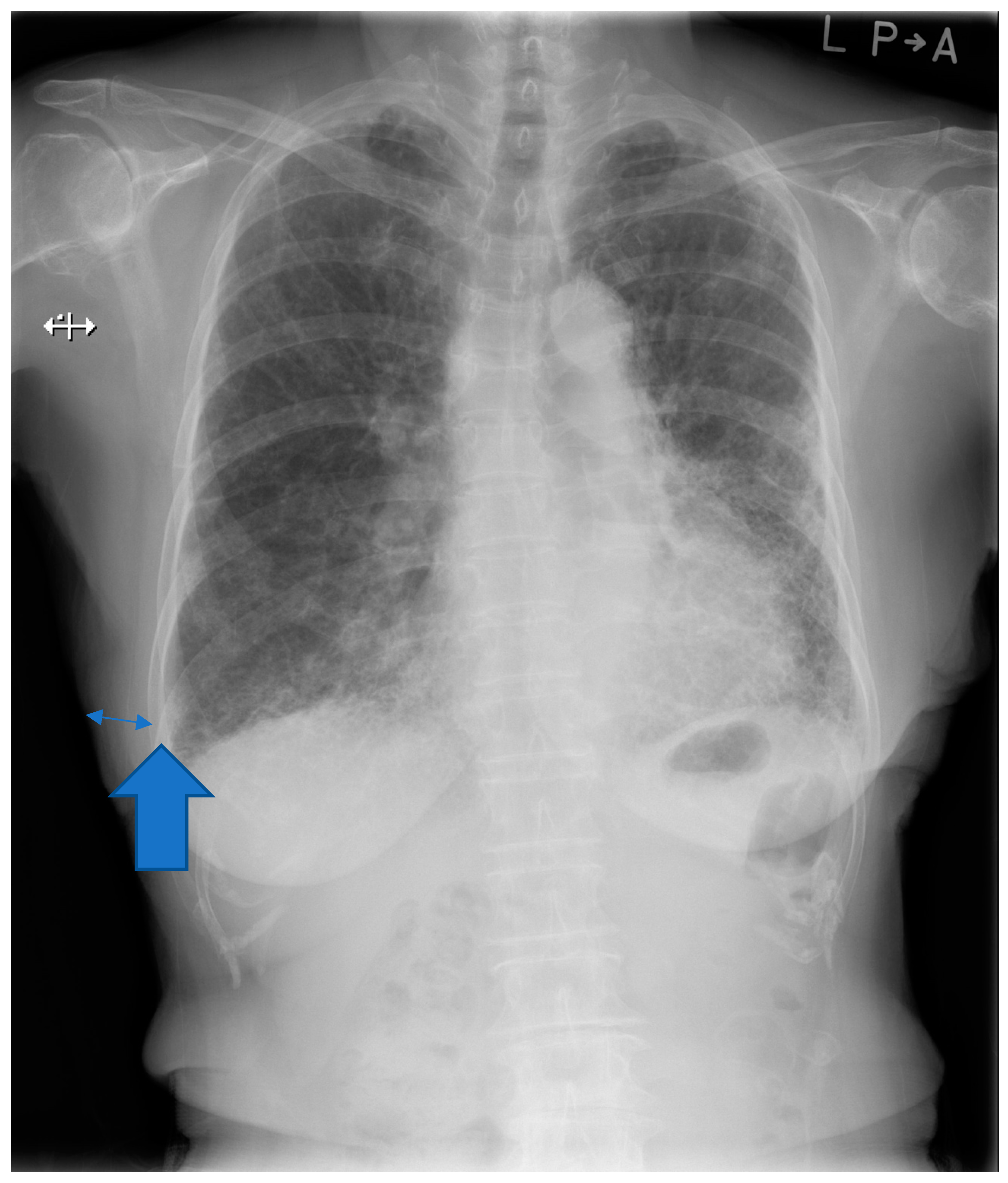 Medicina 57 01121 g001
