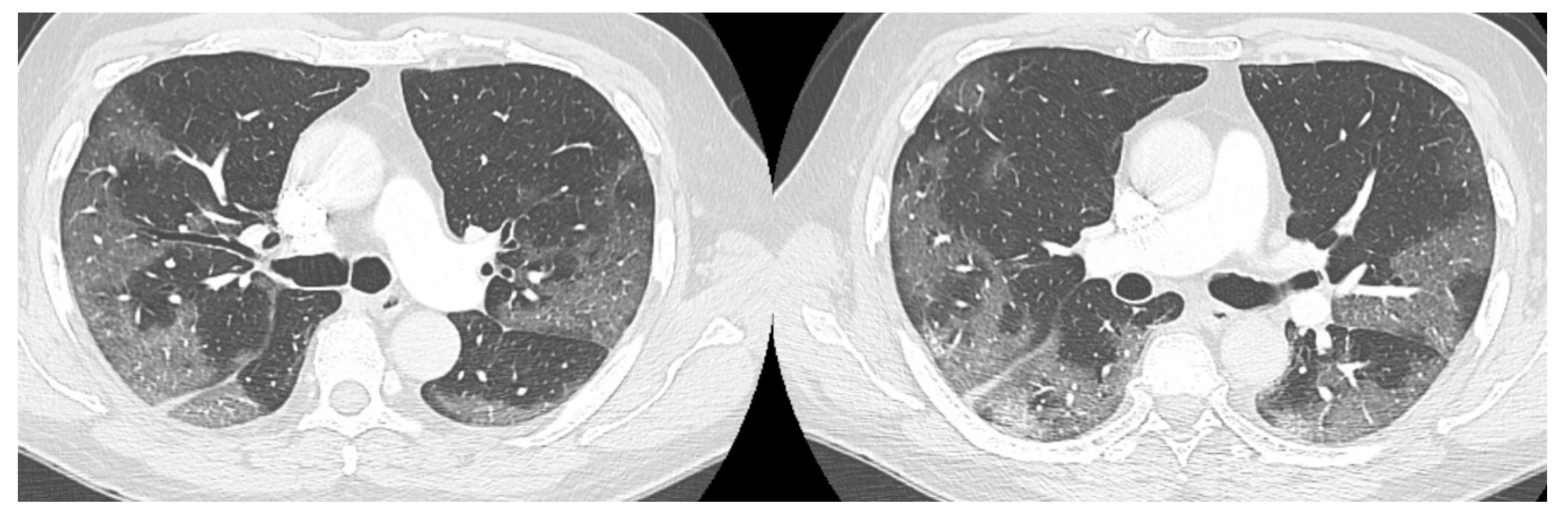 Medicina 57 01122 g001