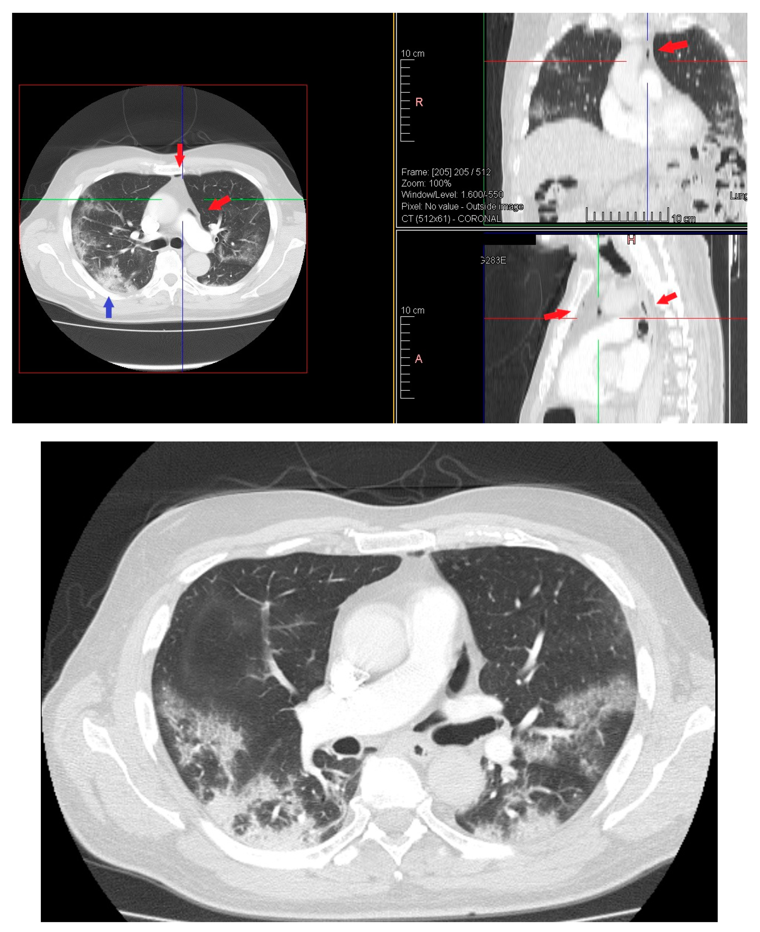 Medicina 57 01122 g003