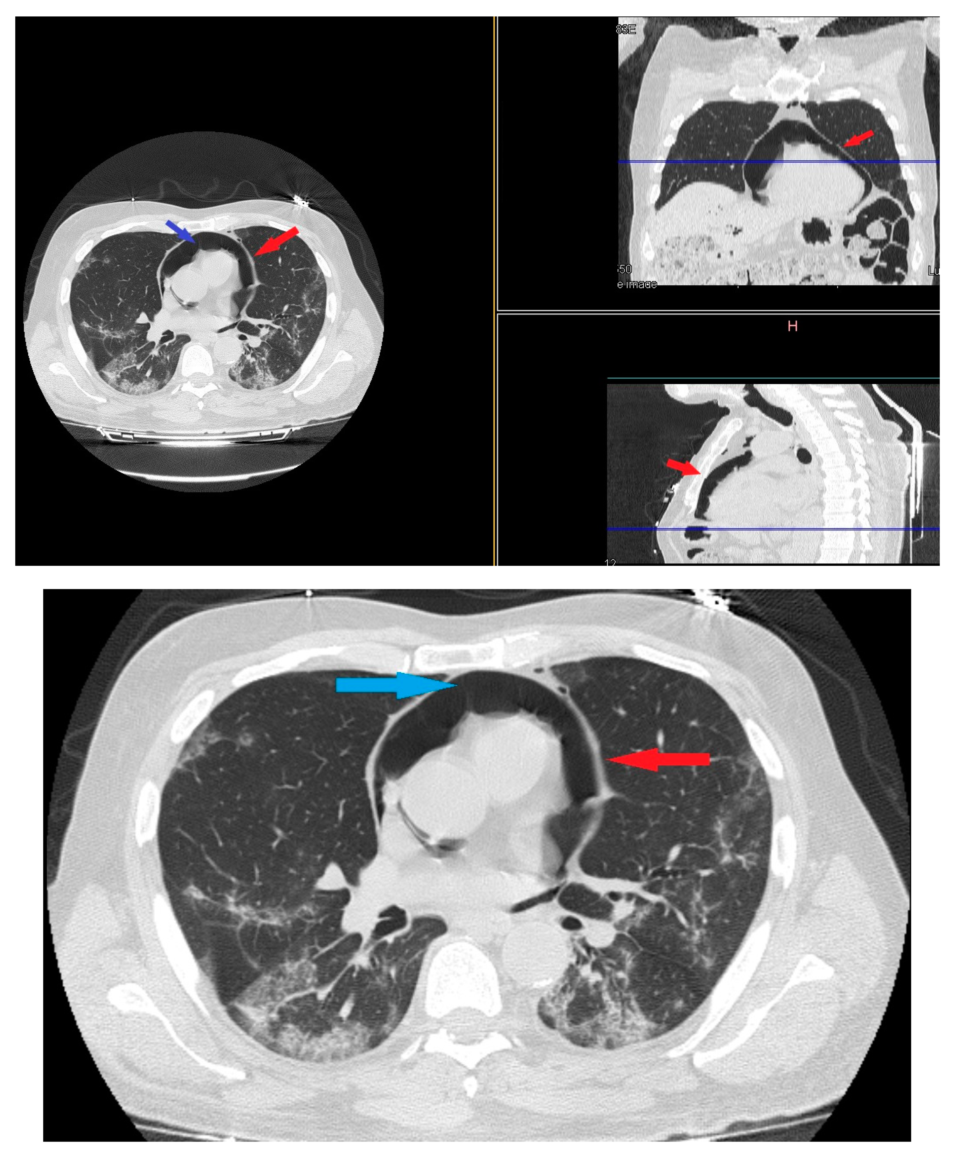 Medicina 57 01122 g004