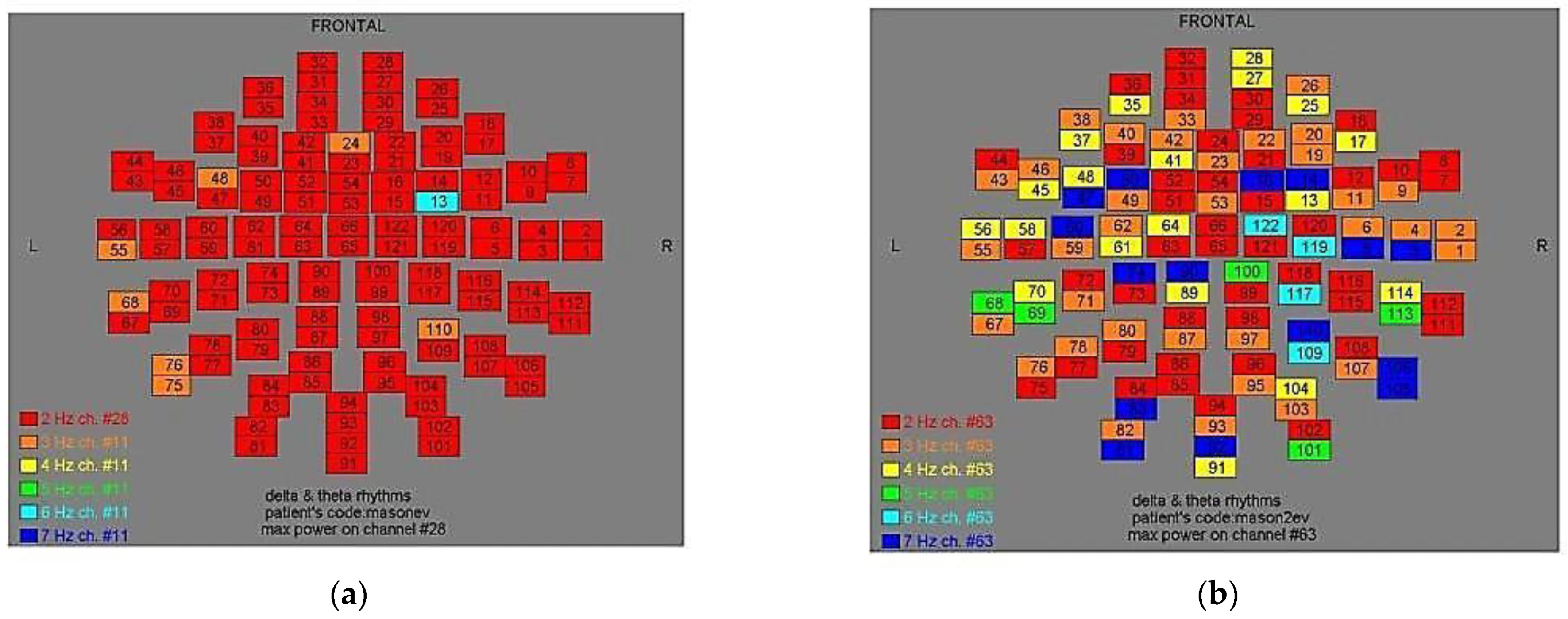 Medicina 57 01164 g004