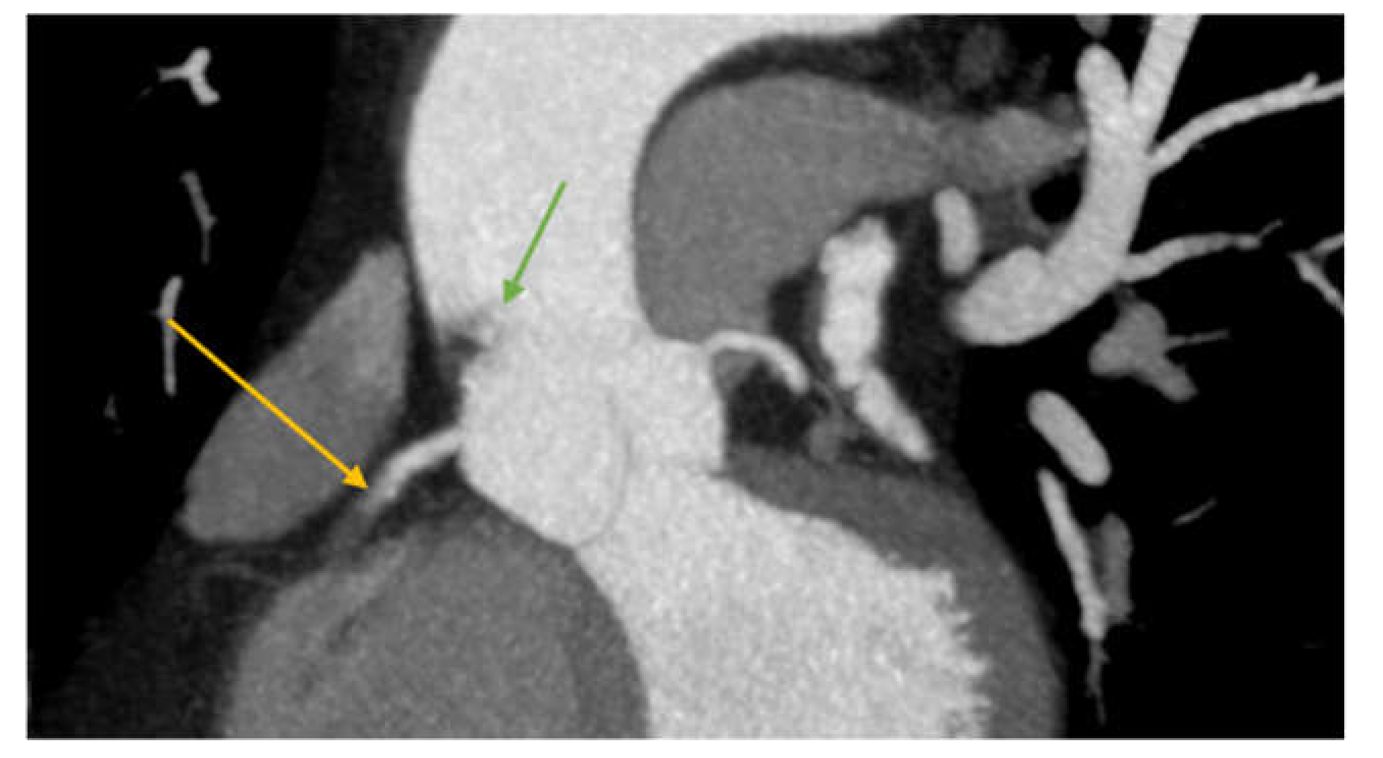 Medicina 57 01176 g005
