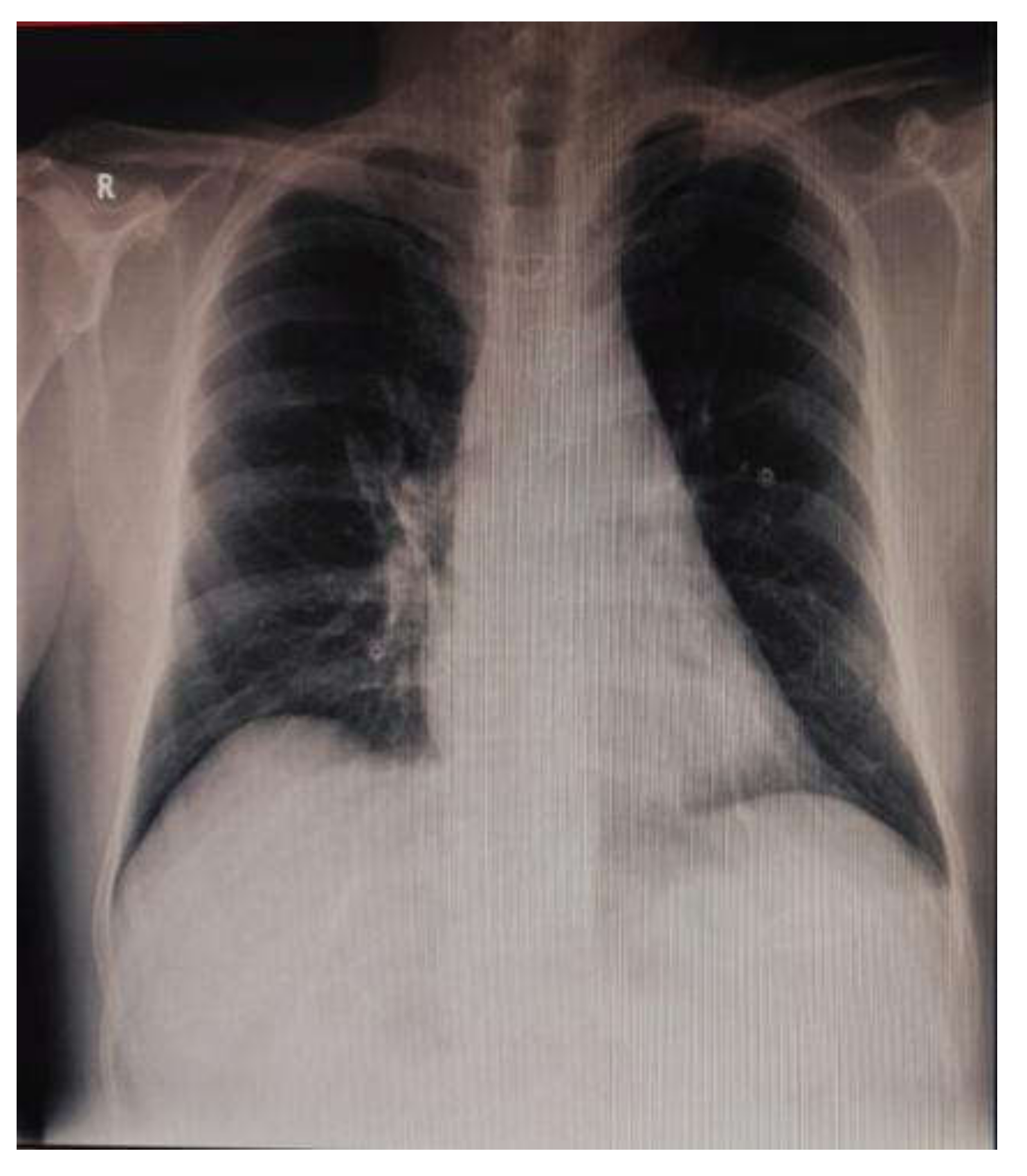 Medicina 57 01176 g007