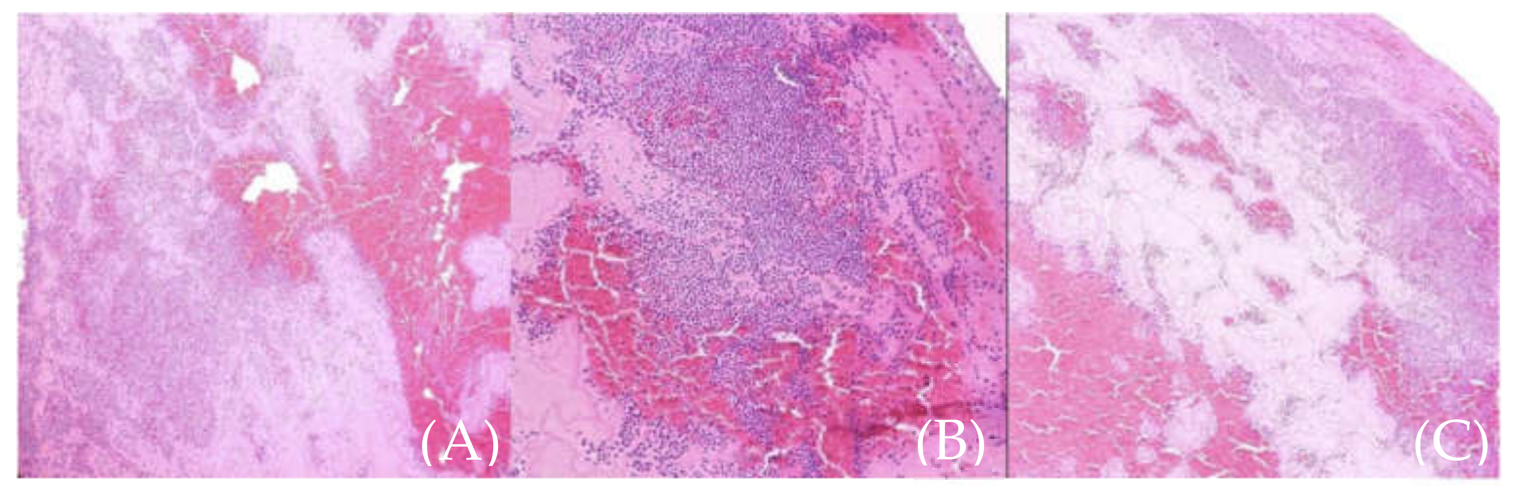 Medicina 57 01176 g008