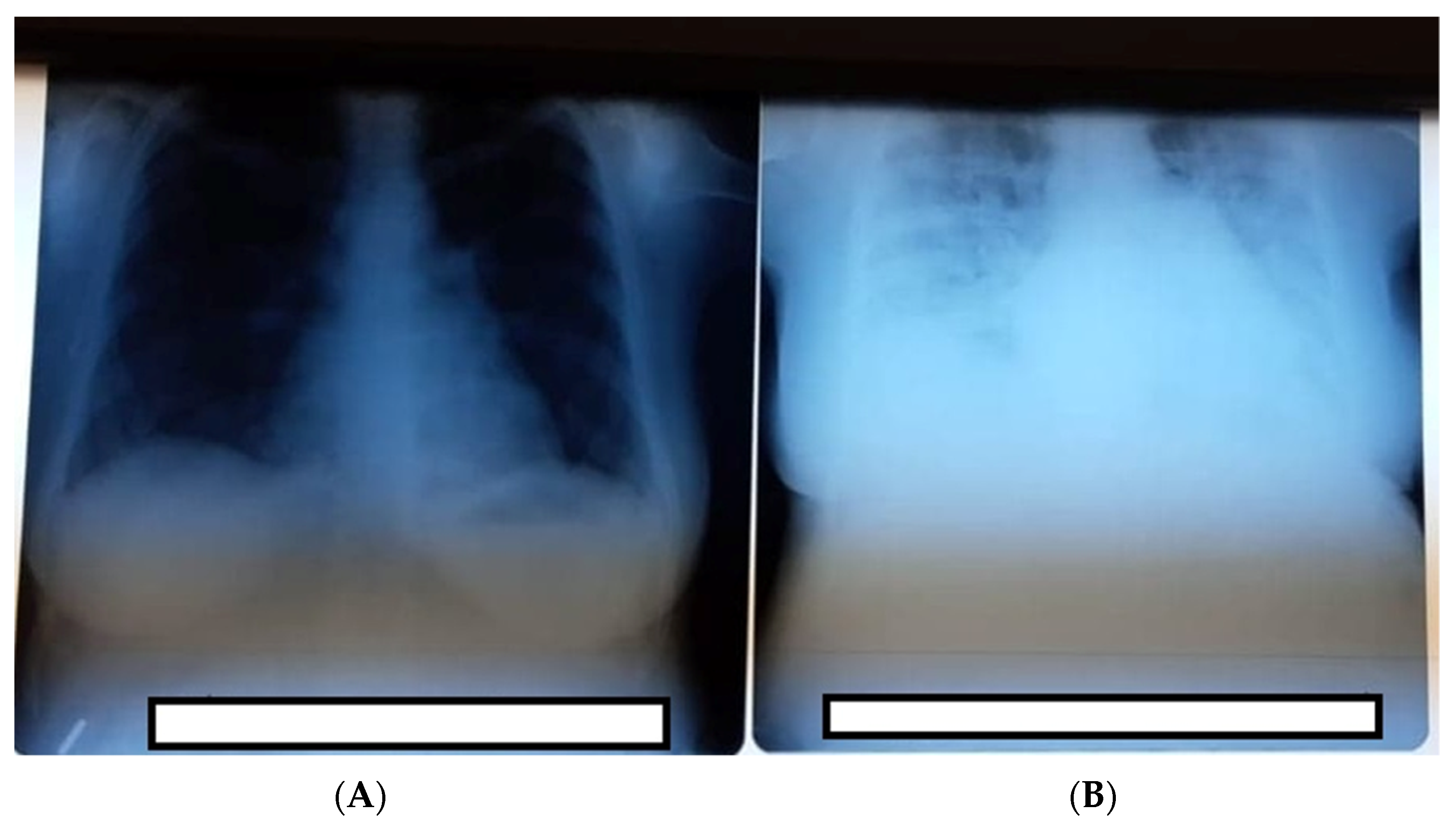 Medicina 57 01186 g001