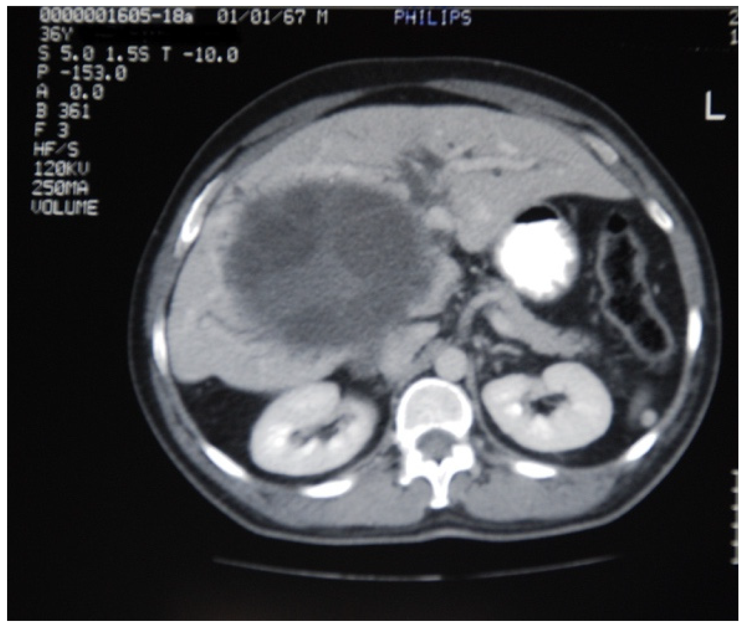 Medicina 57 01210 g002