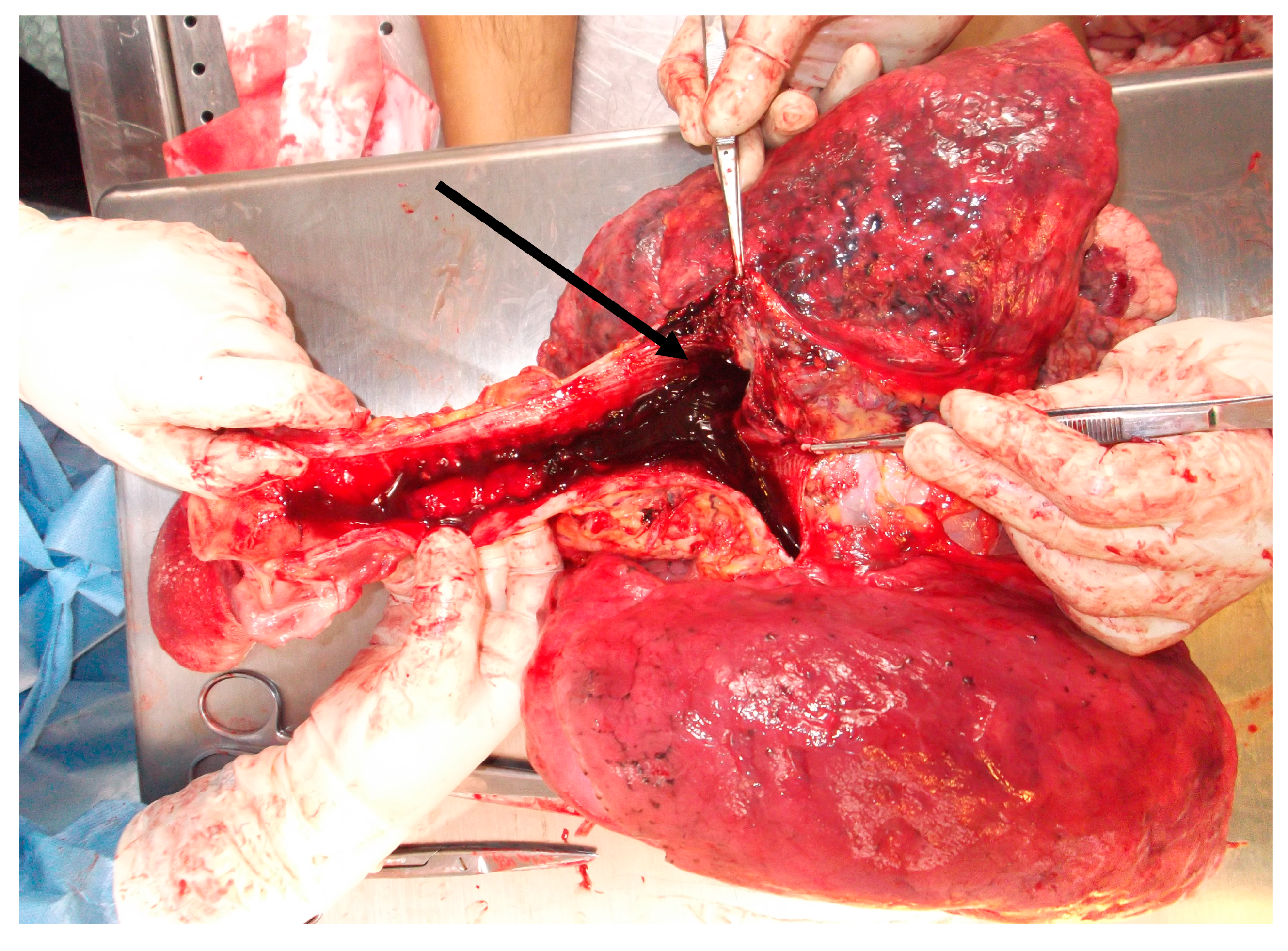 Medicina 57 01231 g002