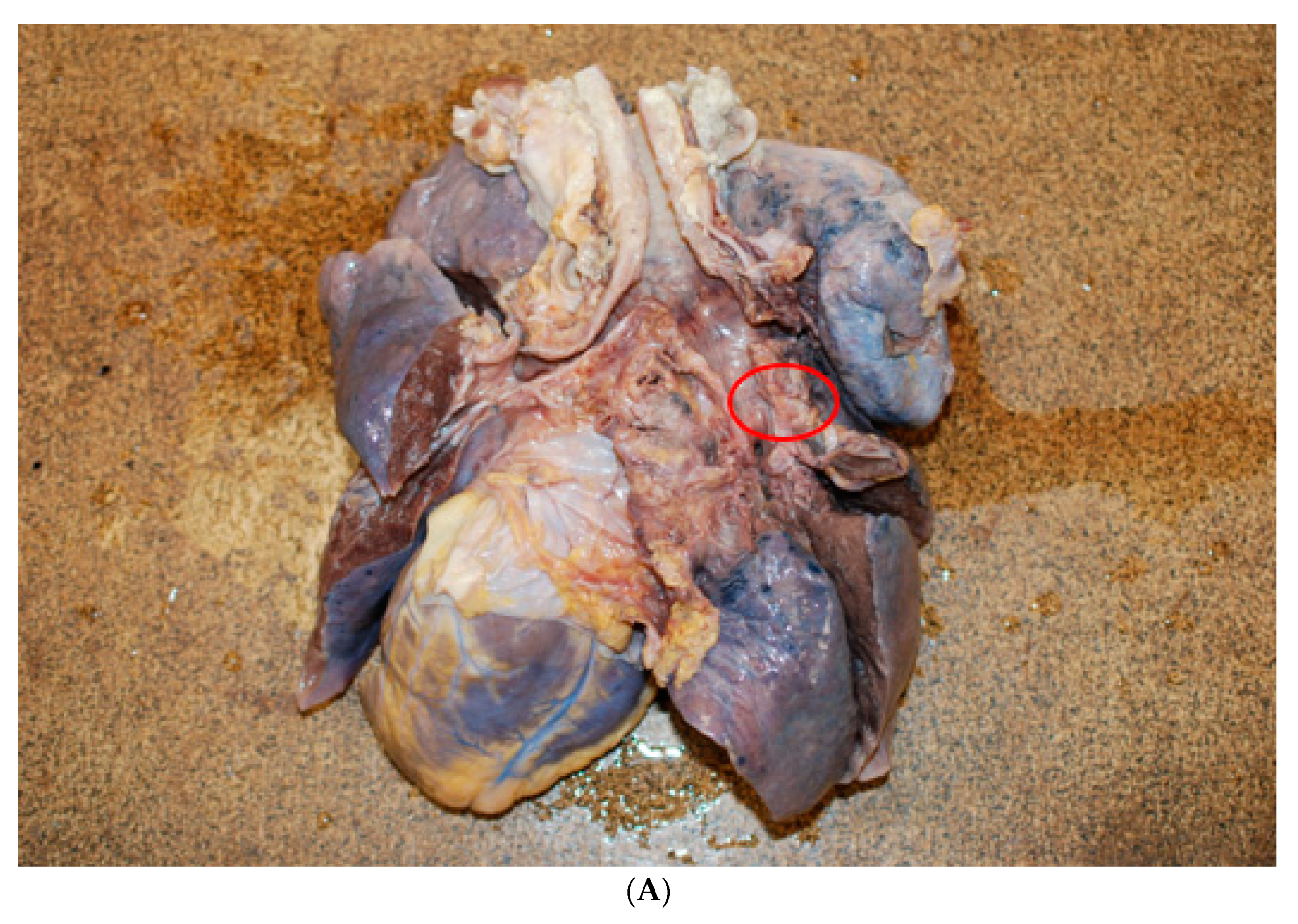 Medicina 57 01231 g003a