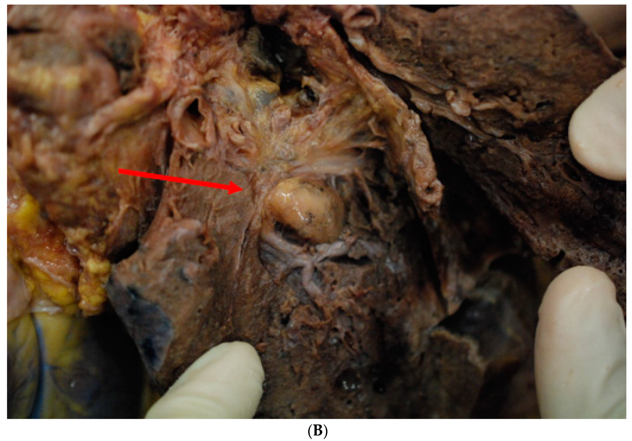 Medicina 57 01231 g003b