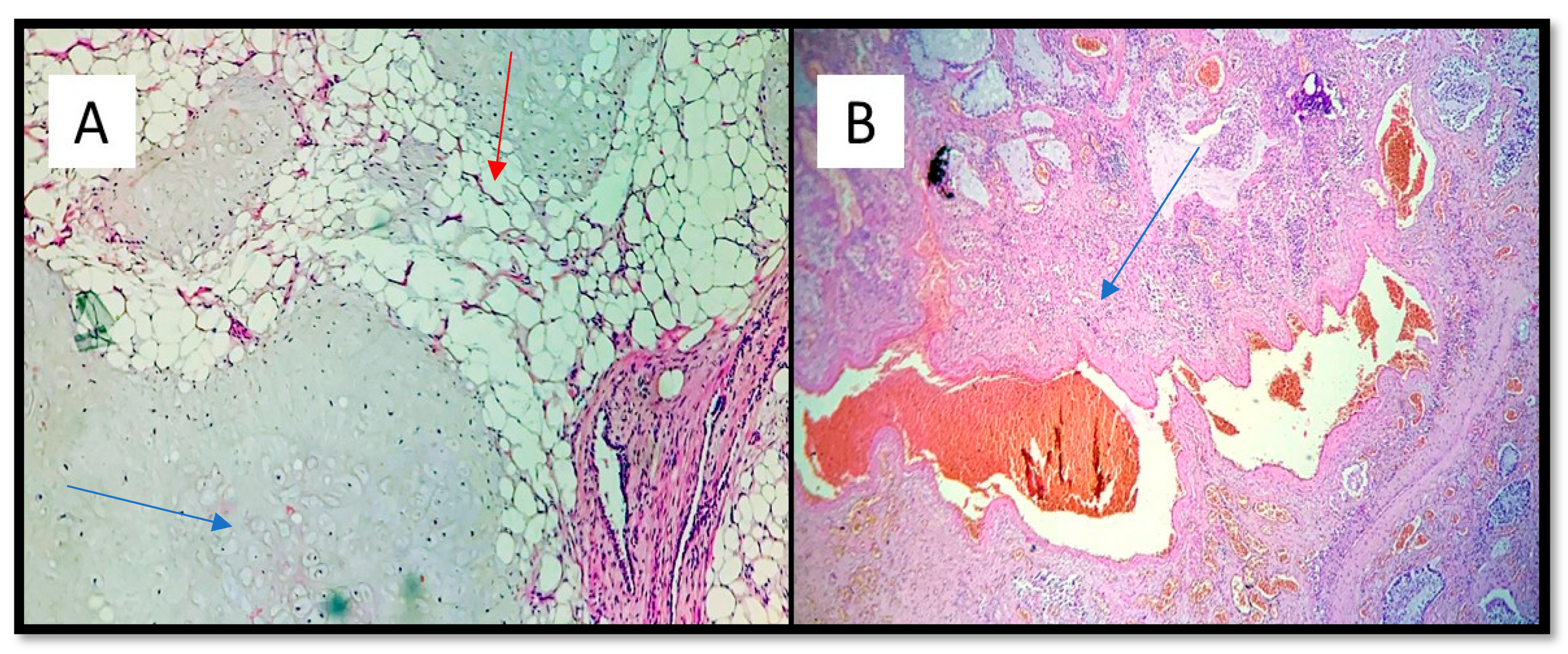 Medicina 57 01231 g004