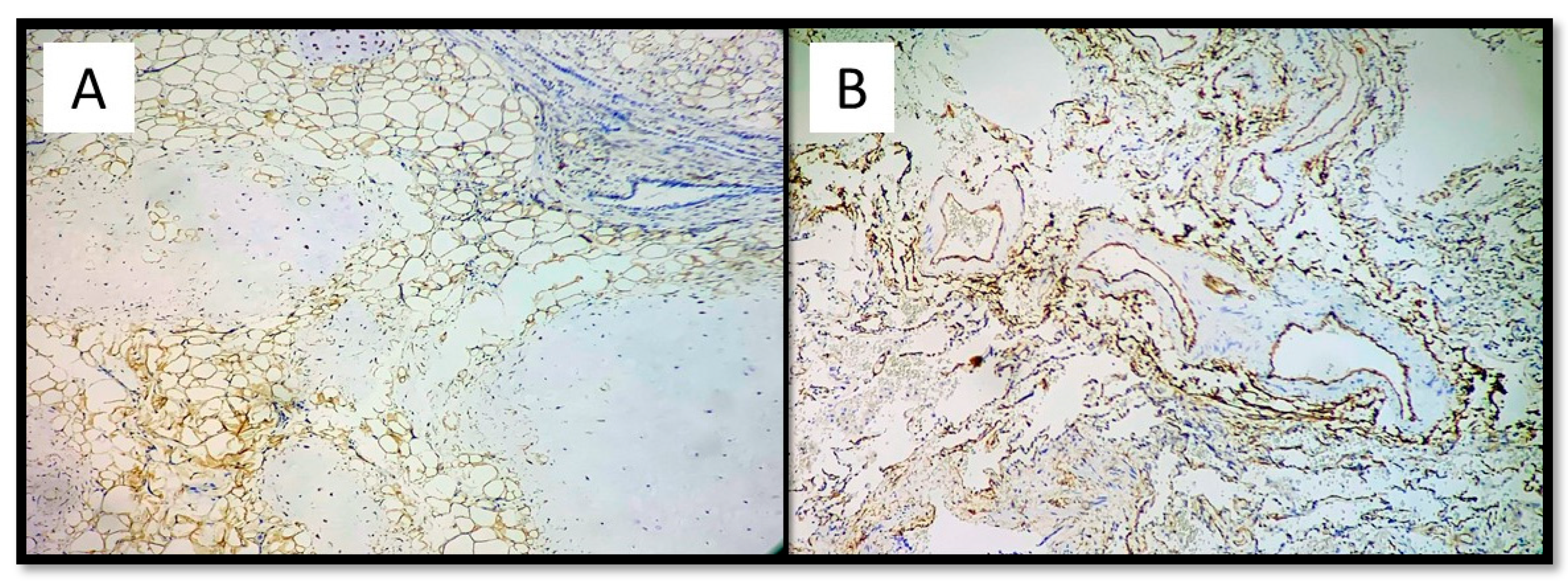 Medicina 57 01231 g005