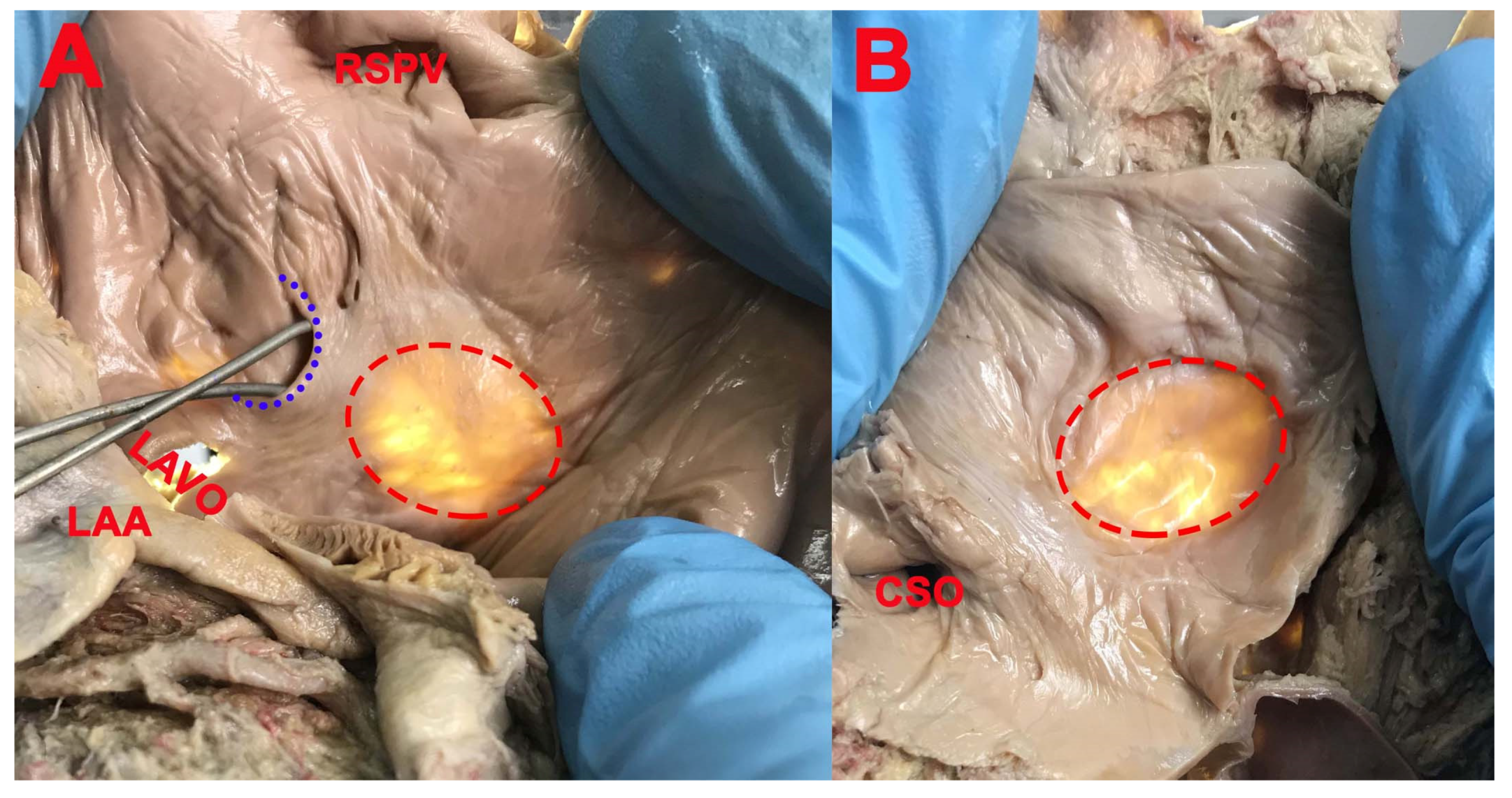 Medicina 57 01254 g004
