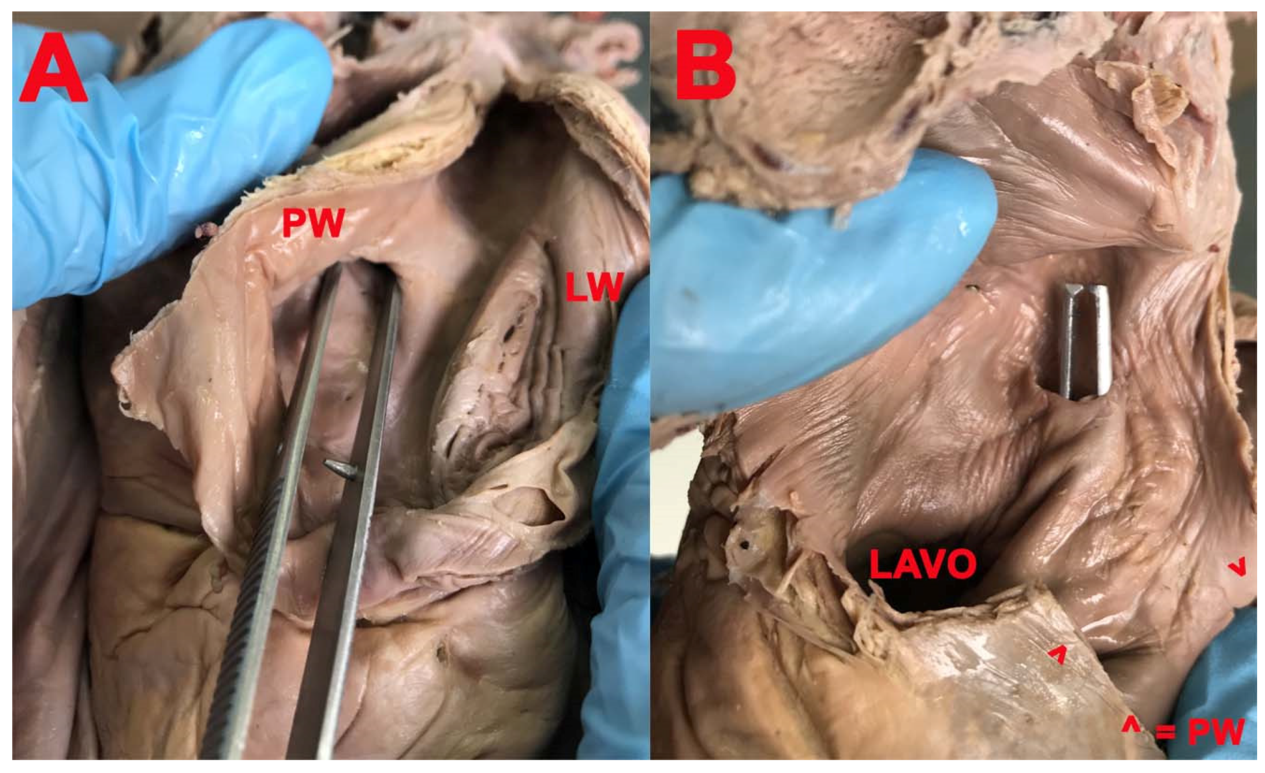 Medicina 57 01254 g006