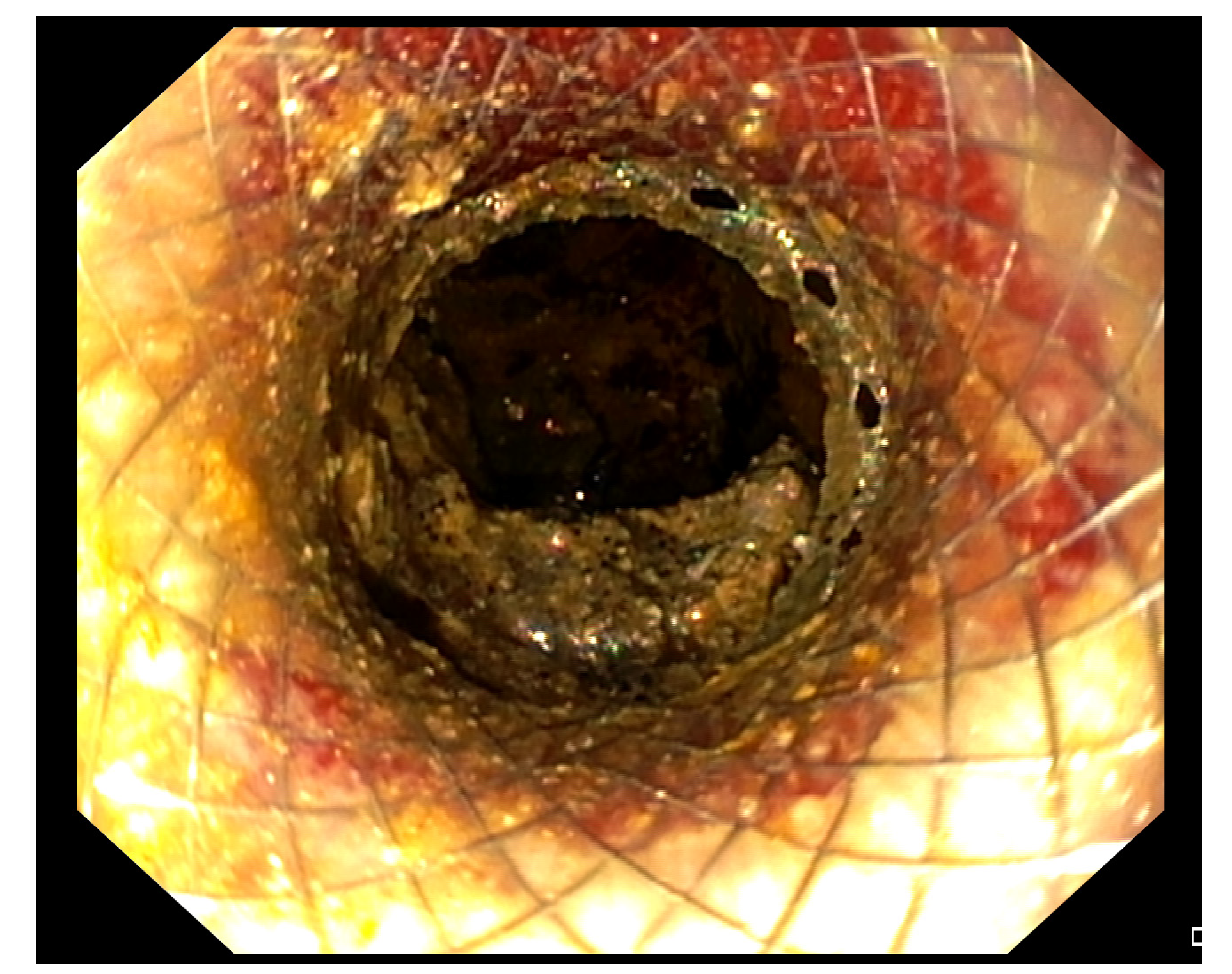 Medicina 57 01305 g002