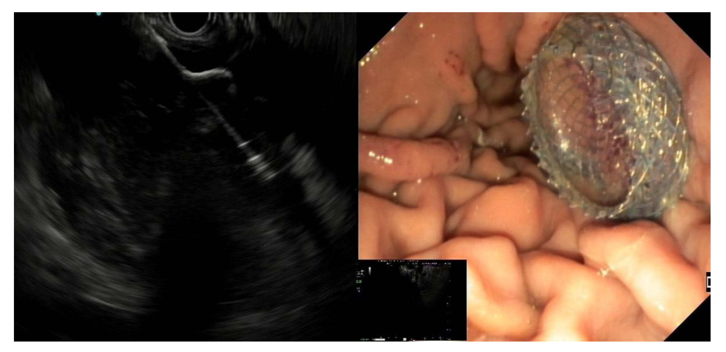 Medicina 57 01305 g003