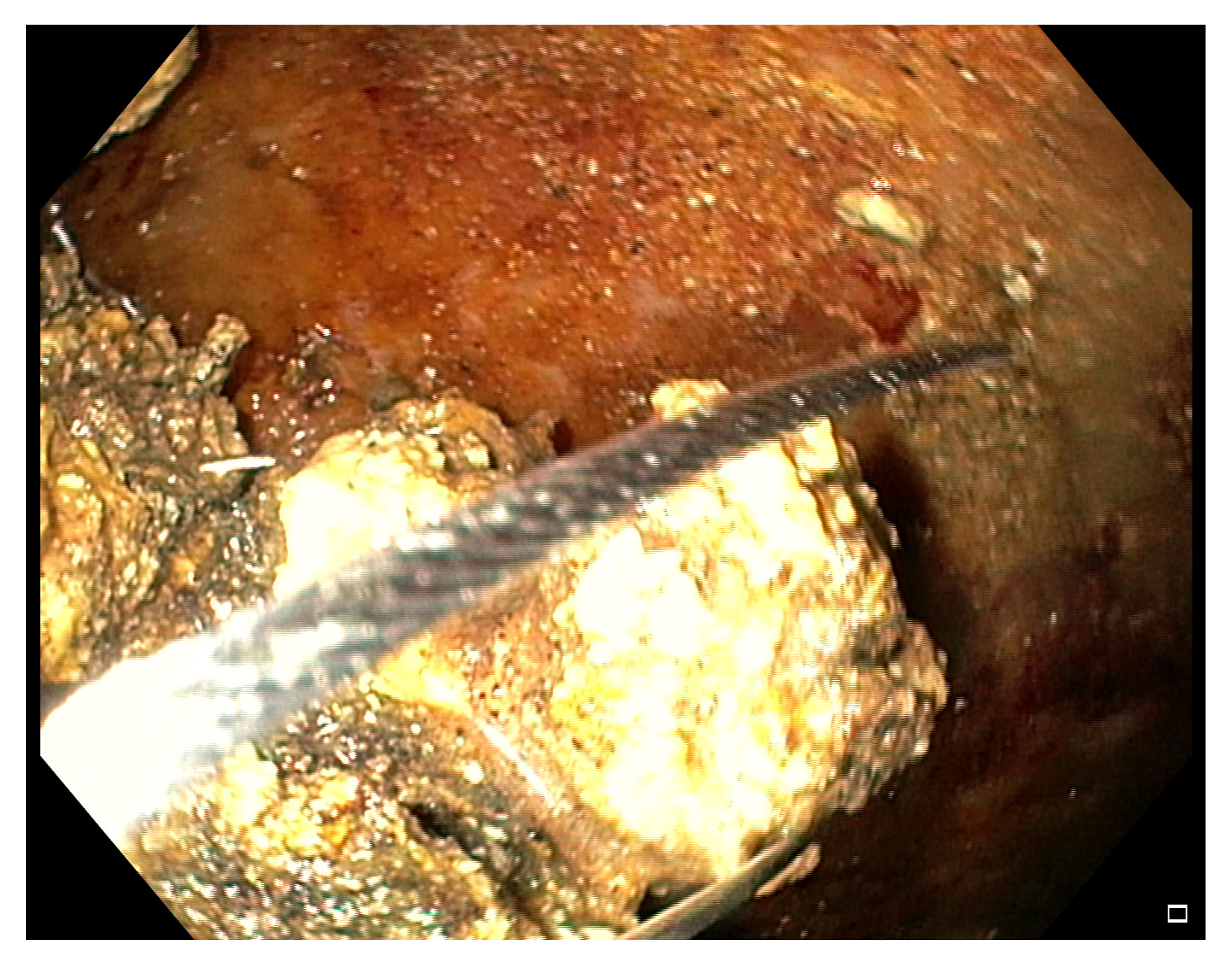 Medicina 57 01305 g004