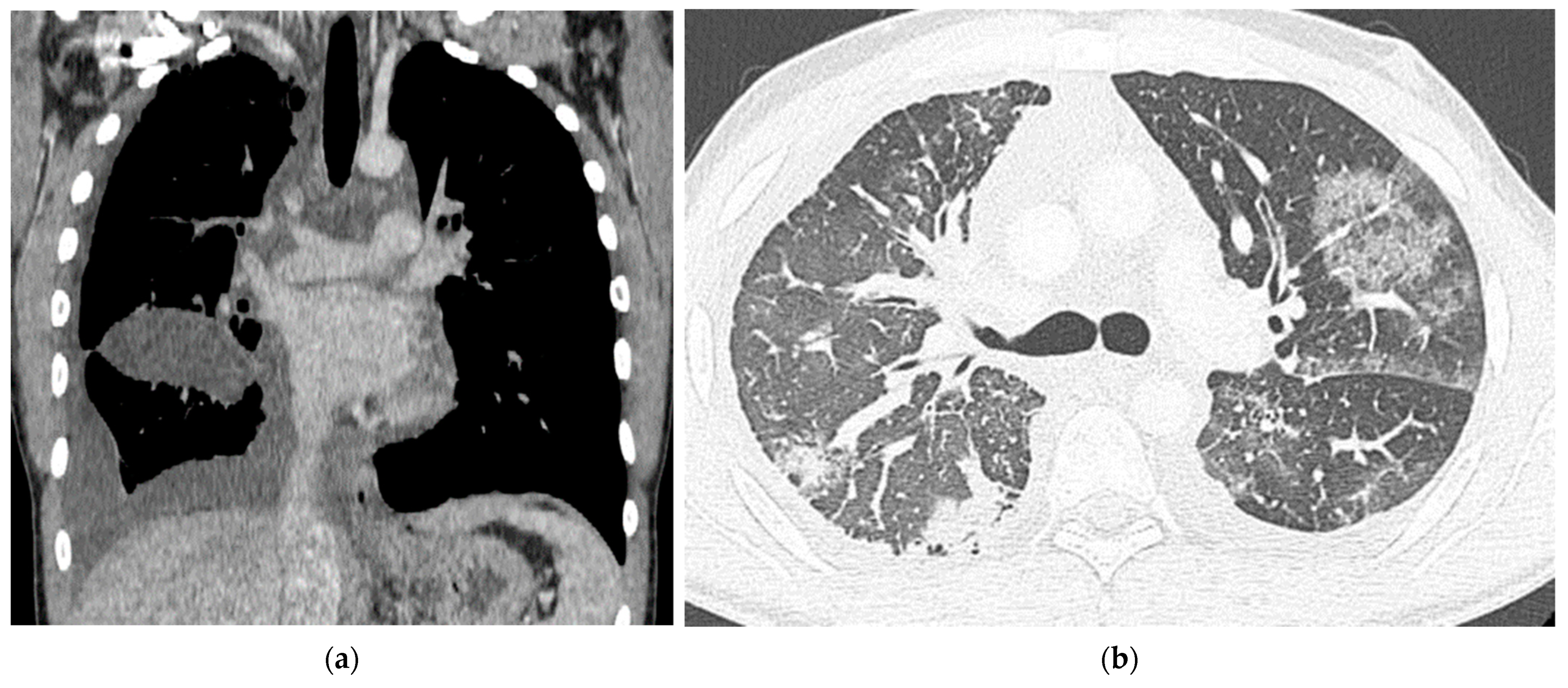 Medicina 57 01308 g001