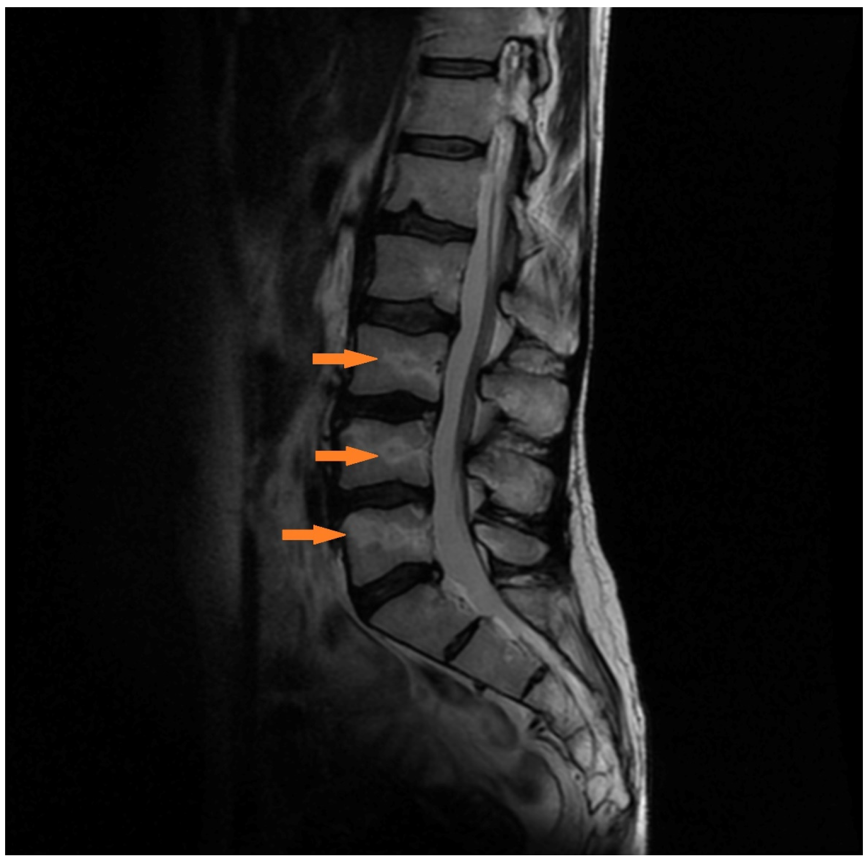 Medicina 57 01311 g003