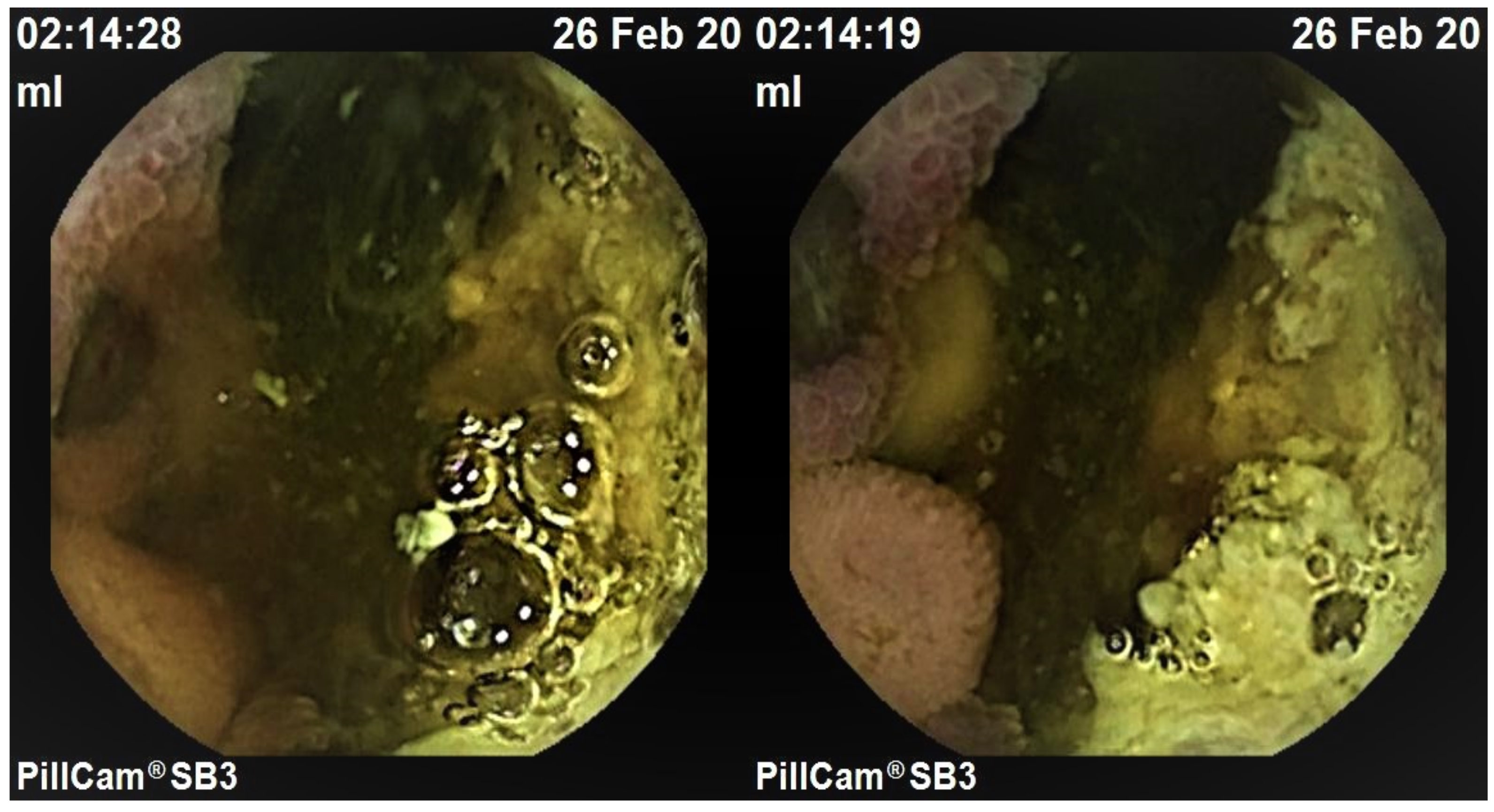 Medicina 57 01313 g001