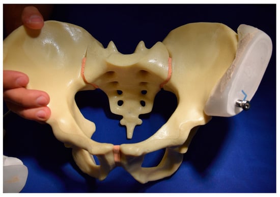 Medicina 57 01368 g0a3 550