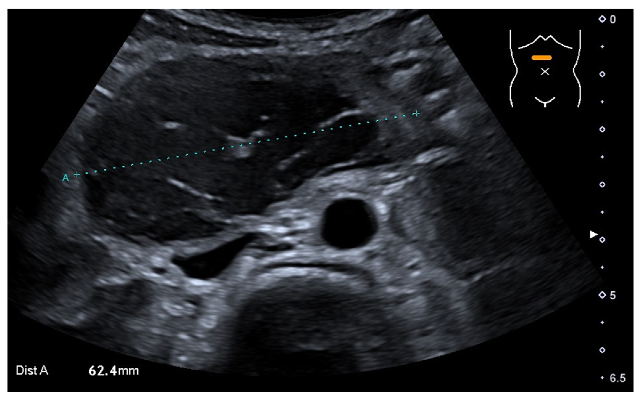 Medicina 58 00012 g001 Medicina 58 00012 g001
