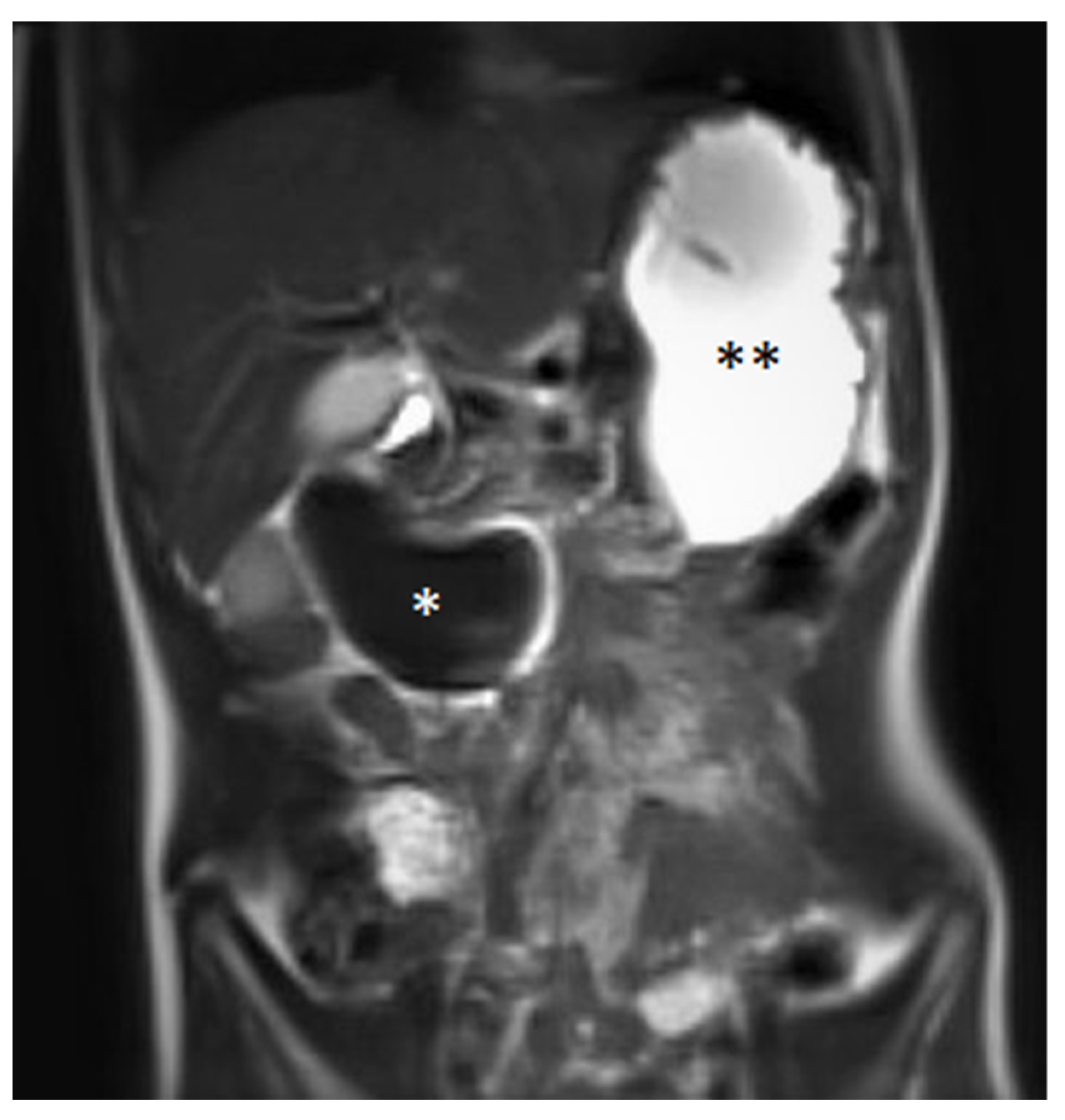 Medicina 58 00012 g002 Medicina 58 00012 g002