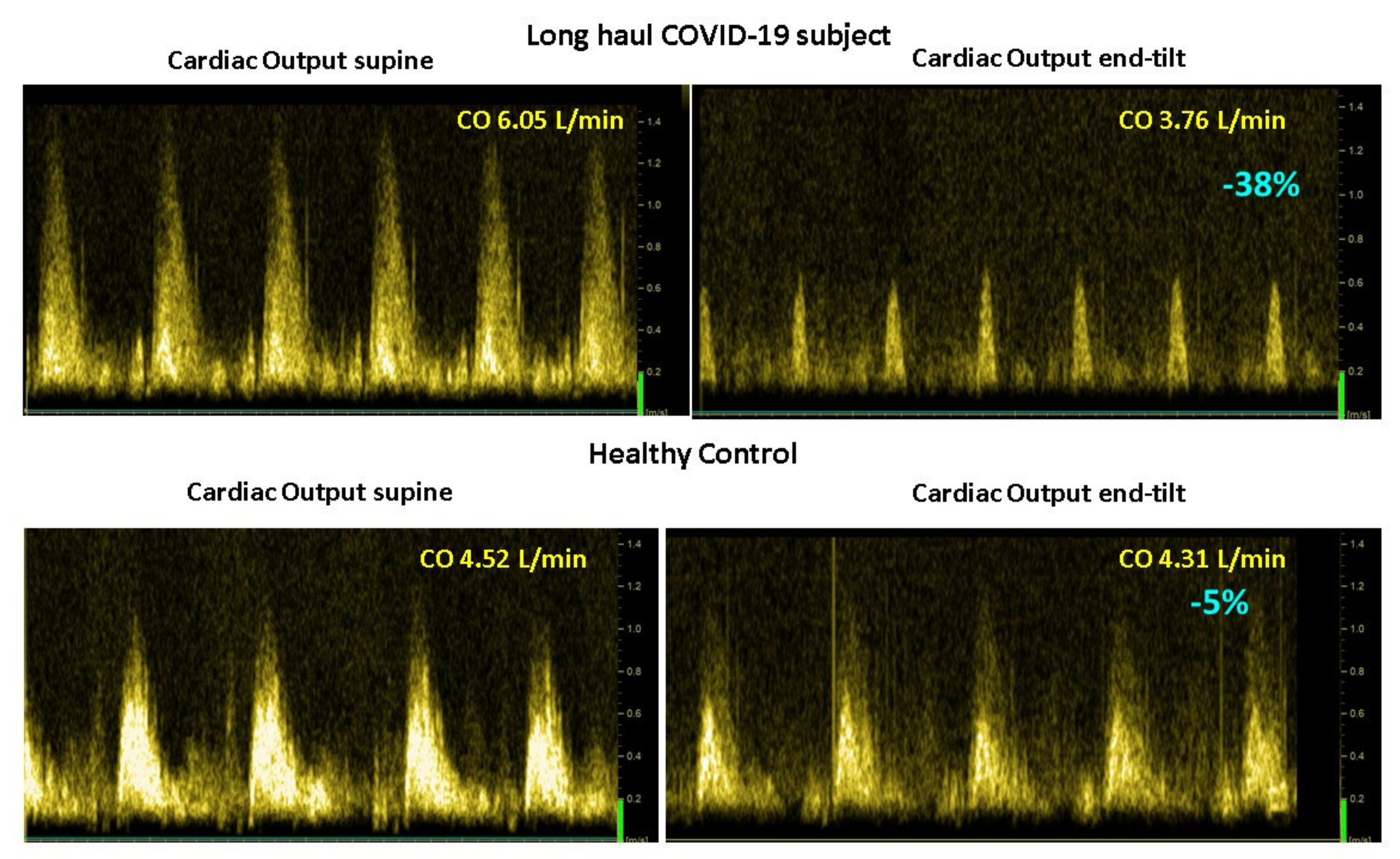 Medicina 58 00028 g005 Medicina 58 00028 g005