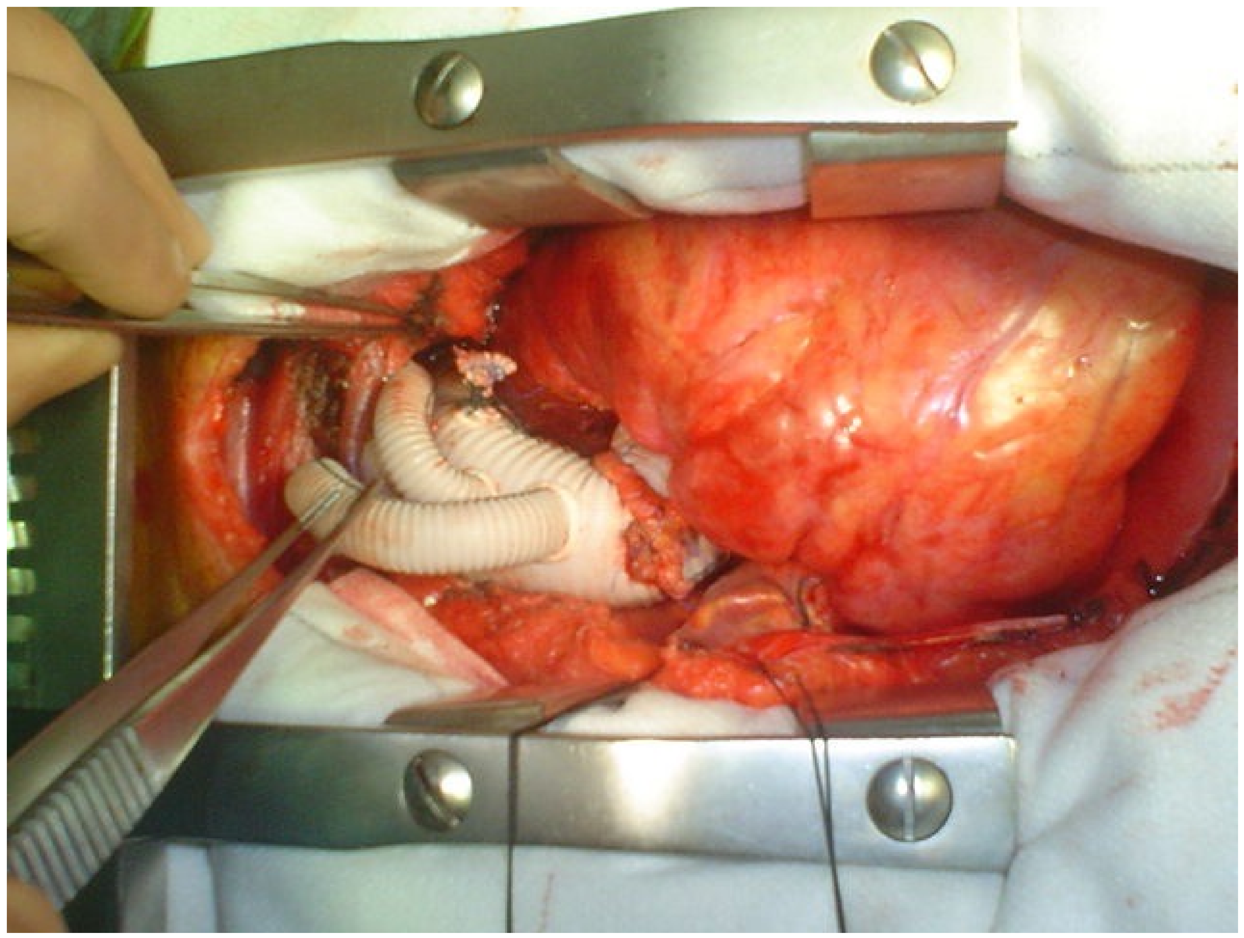 Medicina 58 00049 g004