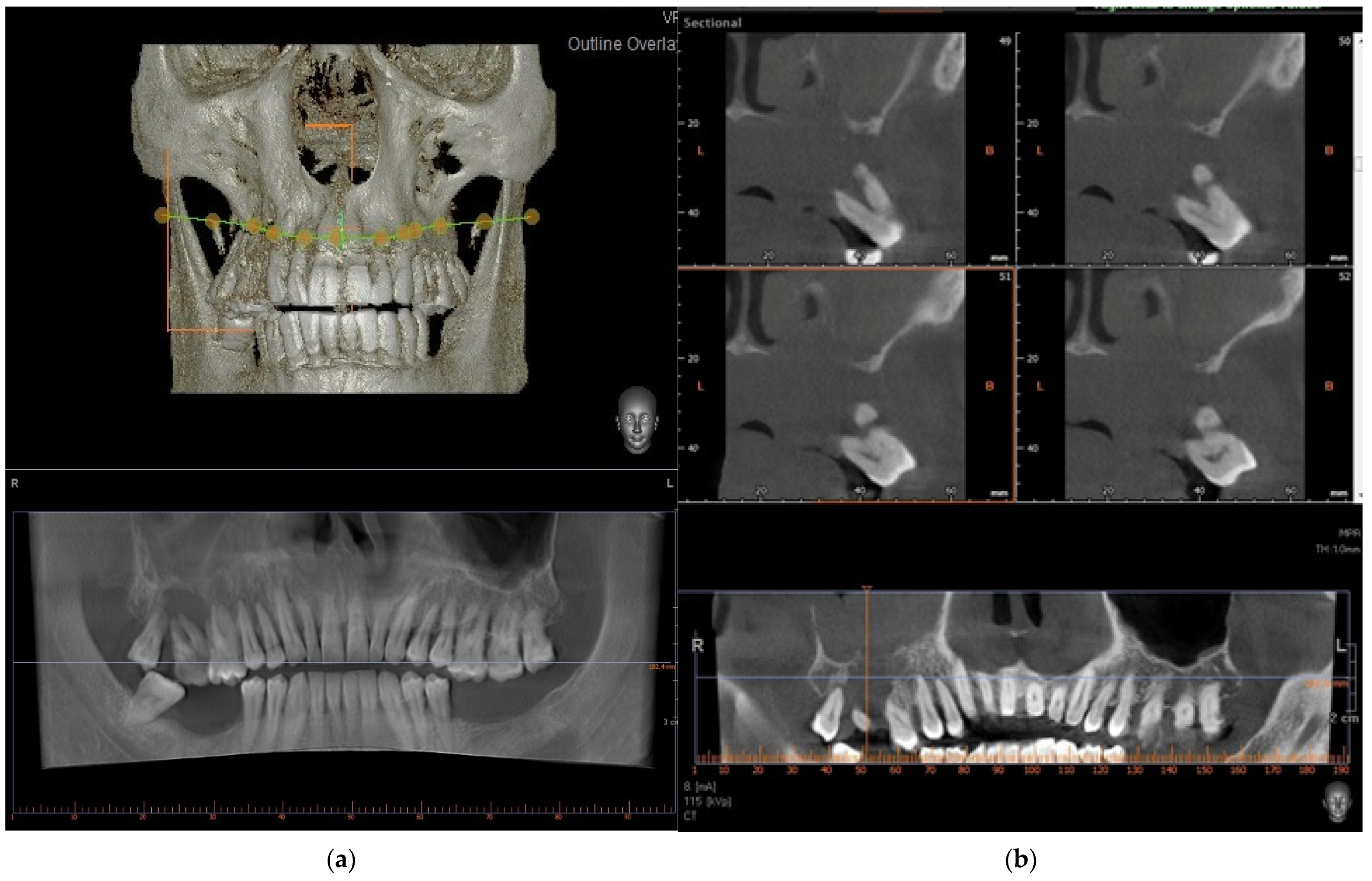 Medicina 58 00054 g002