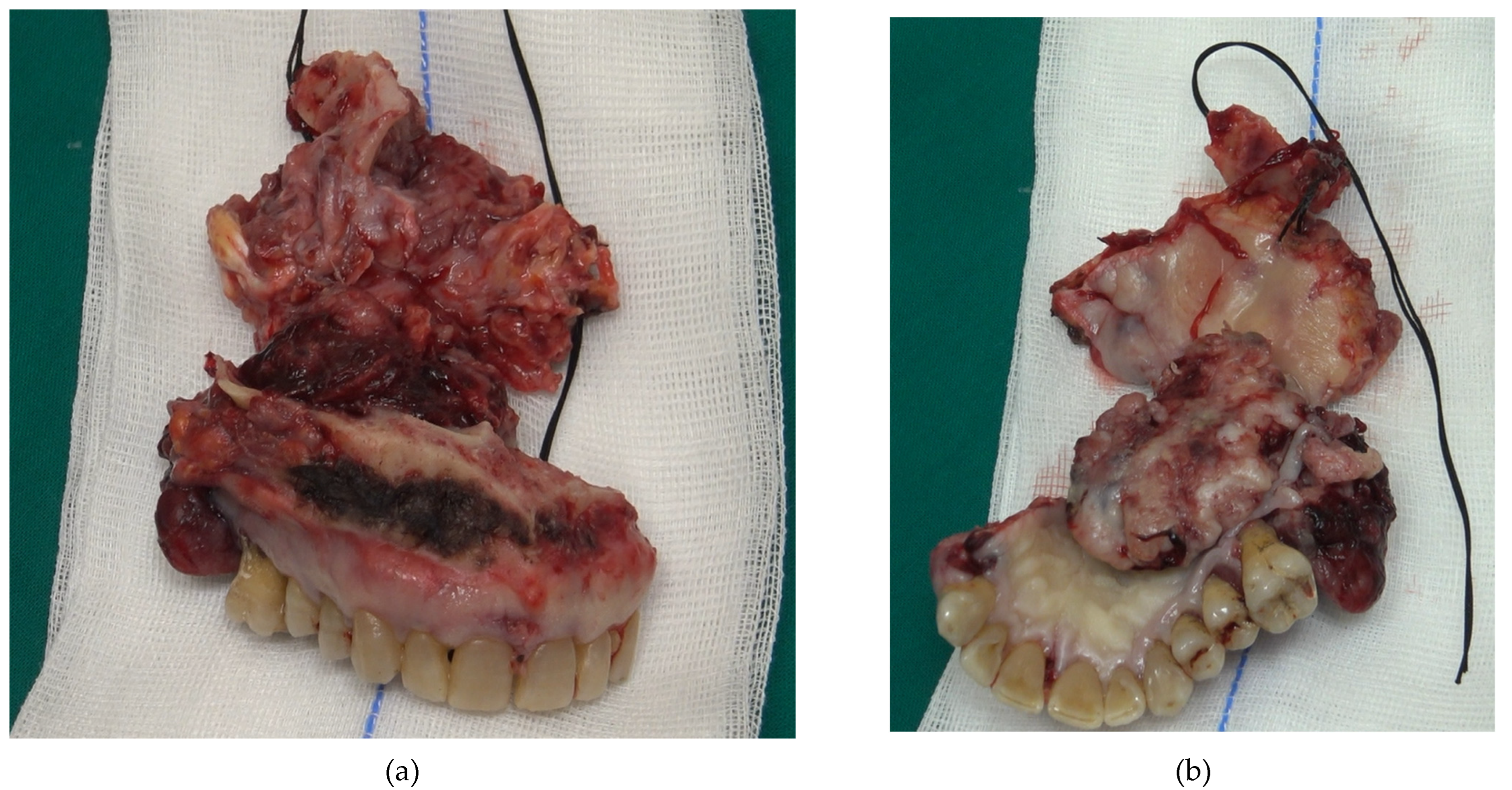 Medicina 58 00054 g003