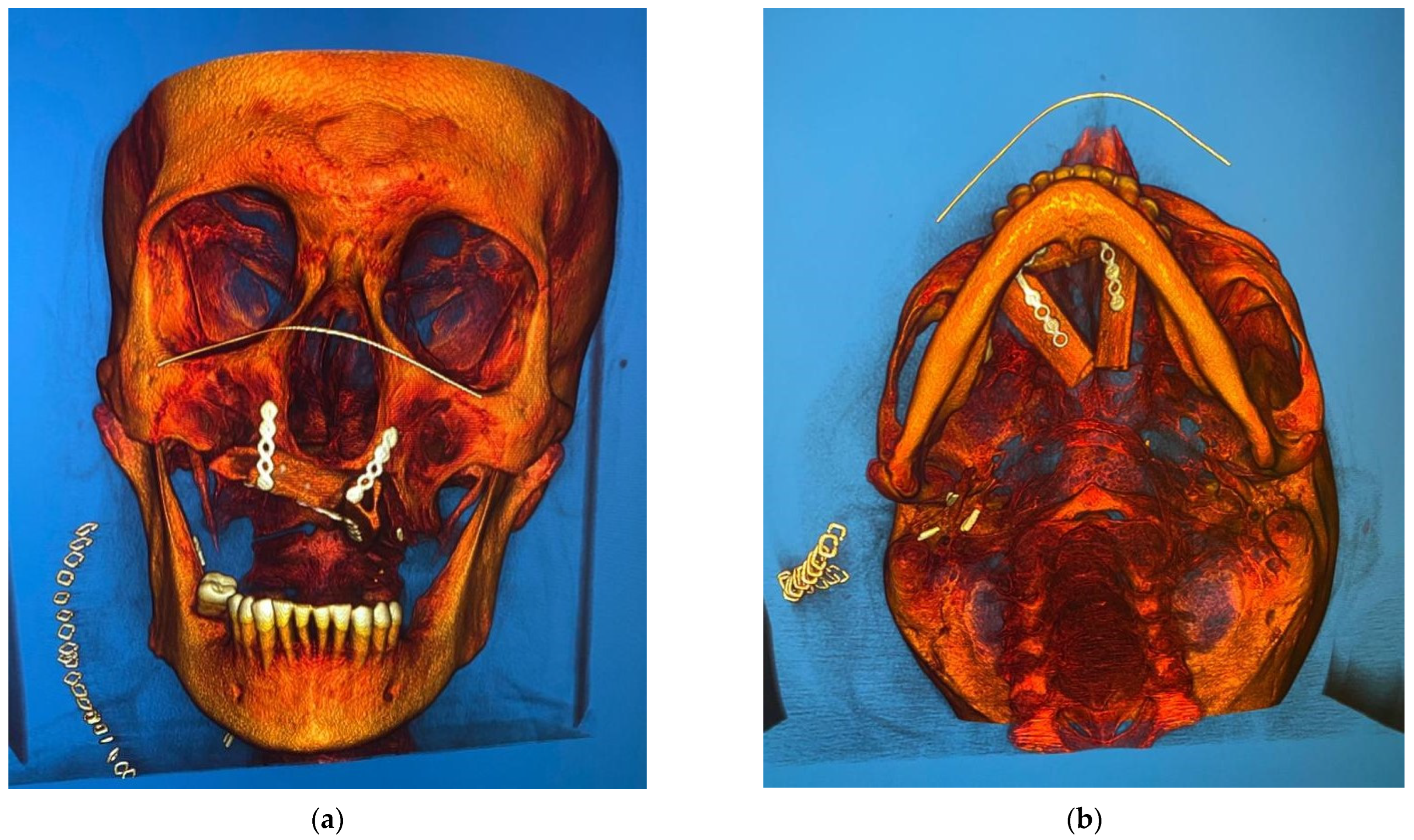 Medicina 58 00054 g005