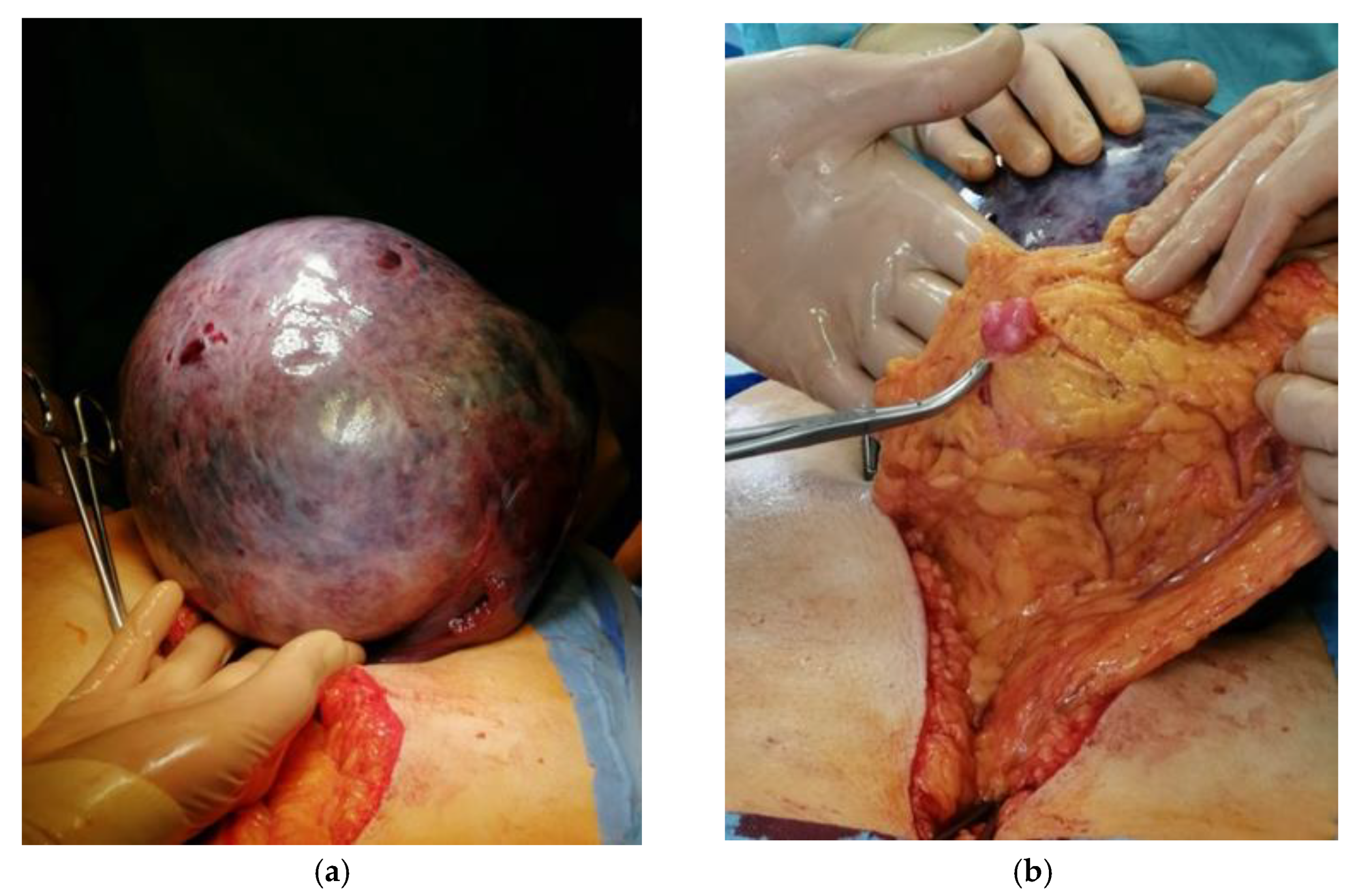 Medicina 58 00089 g002