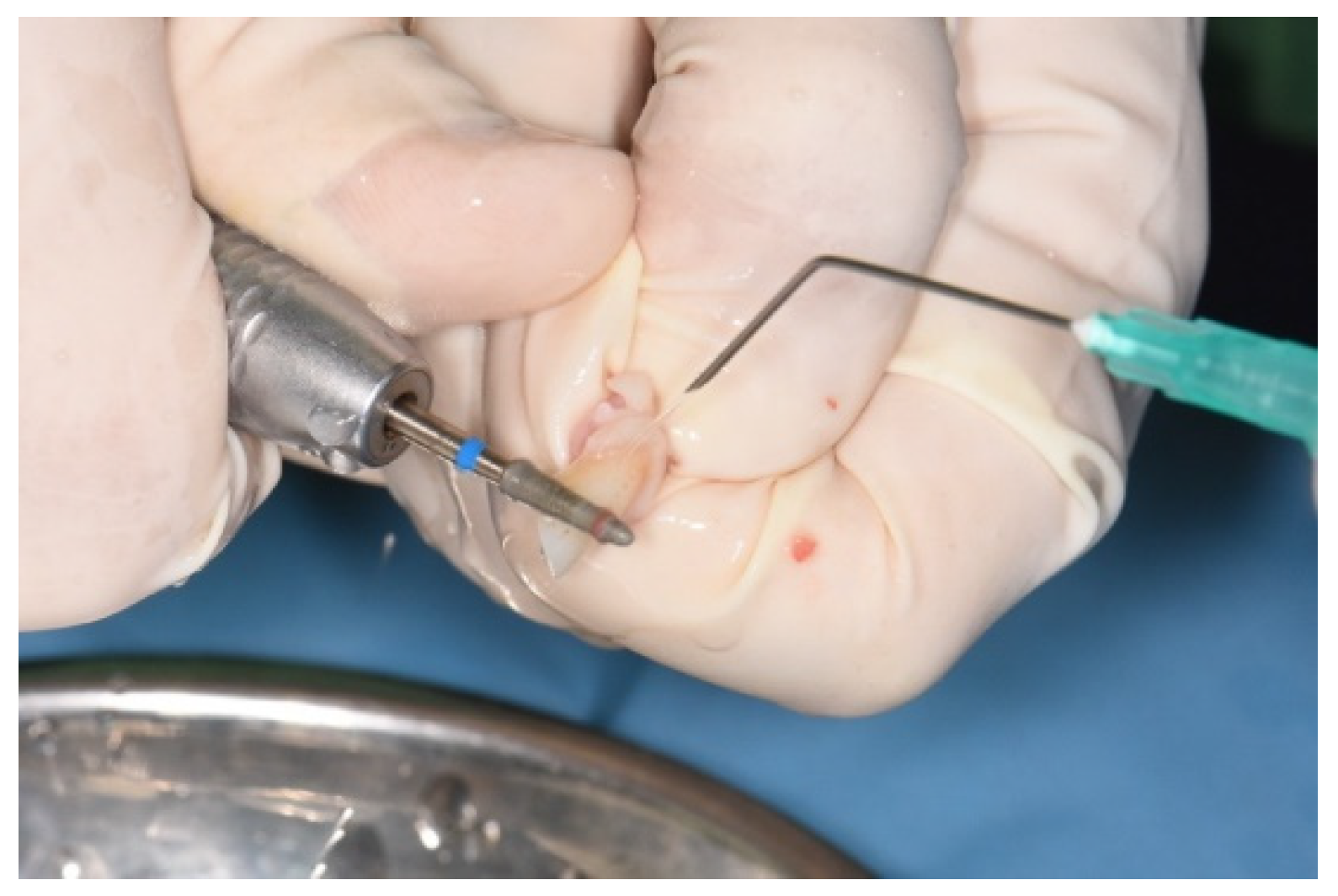 Medicina 58 00103 g005