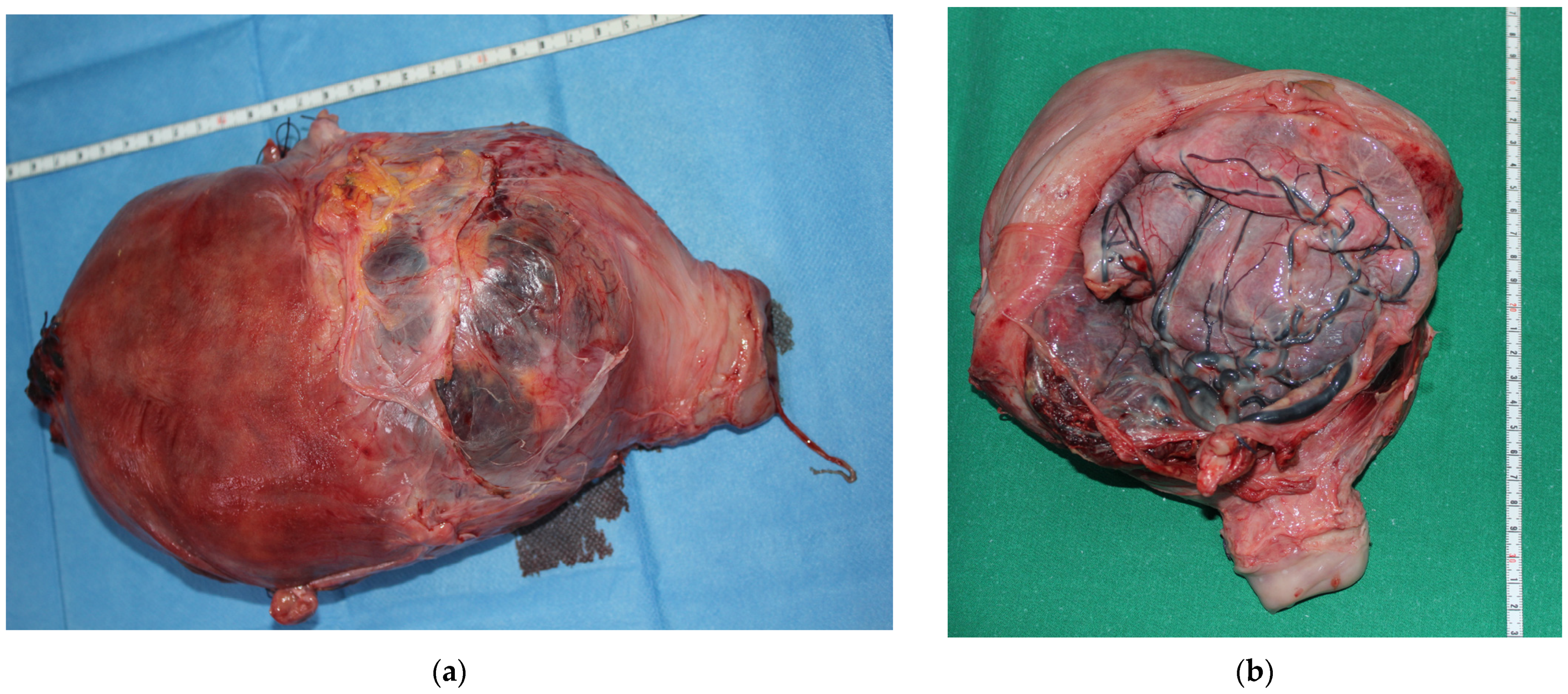 Medicina 58 00111 g001a