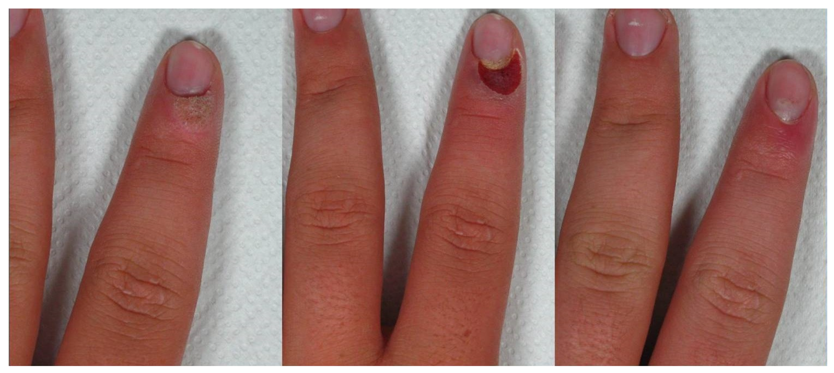 Medicina 58 00115 g001