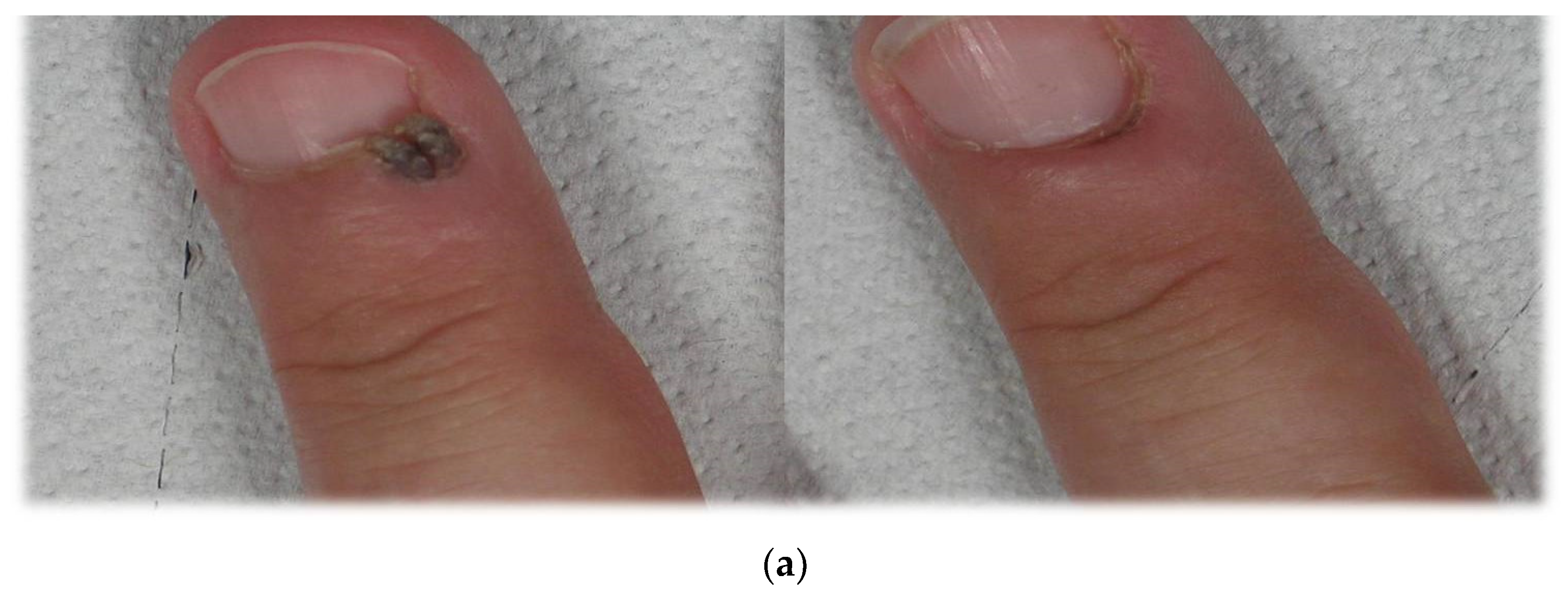 Medicina 58 00115 g002a