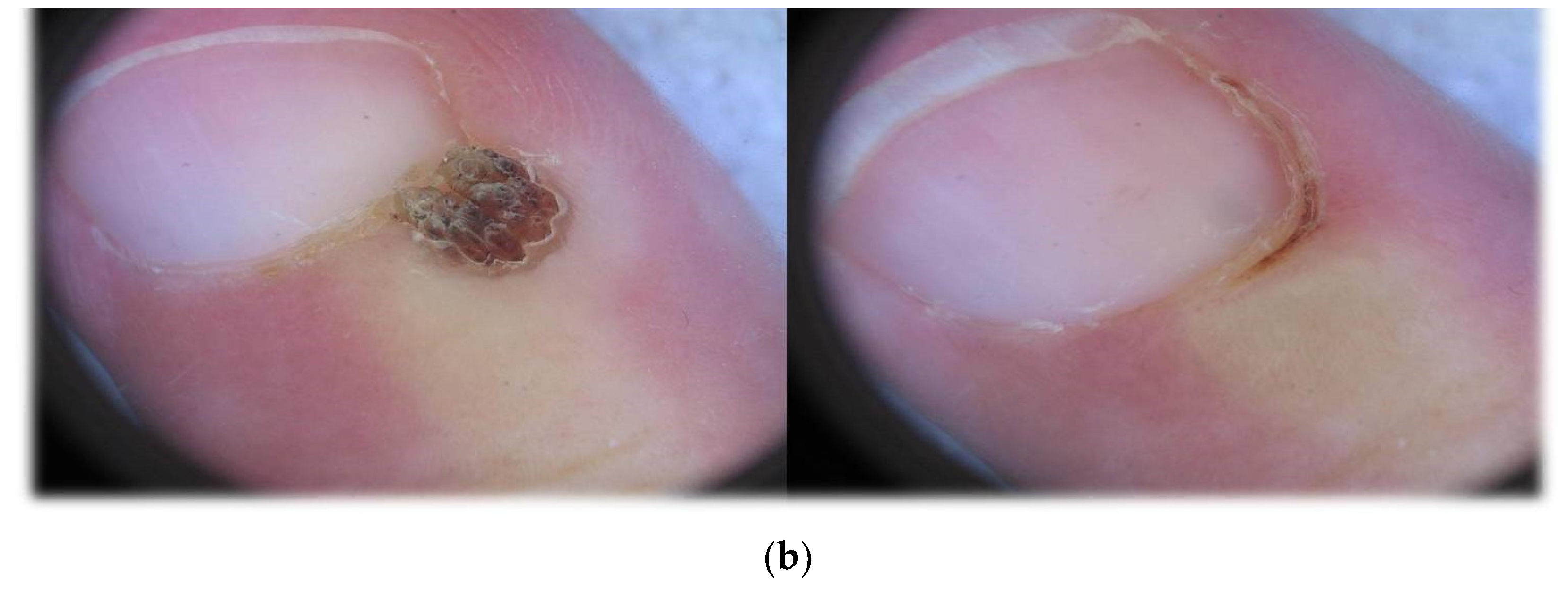 Medicina 58 00115 g002b