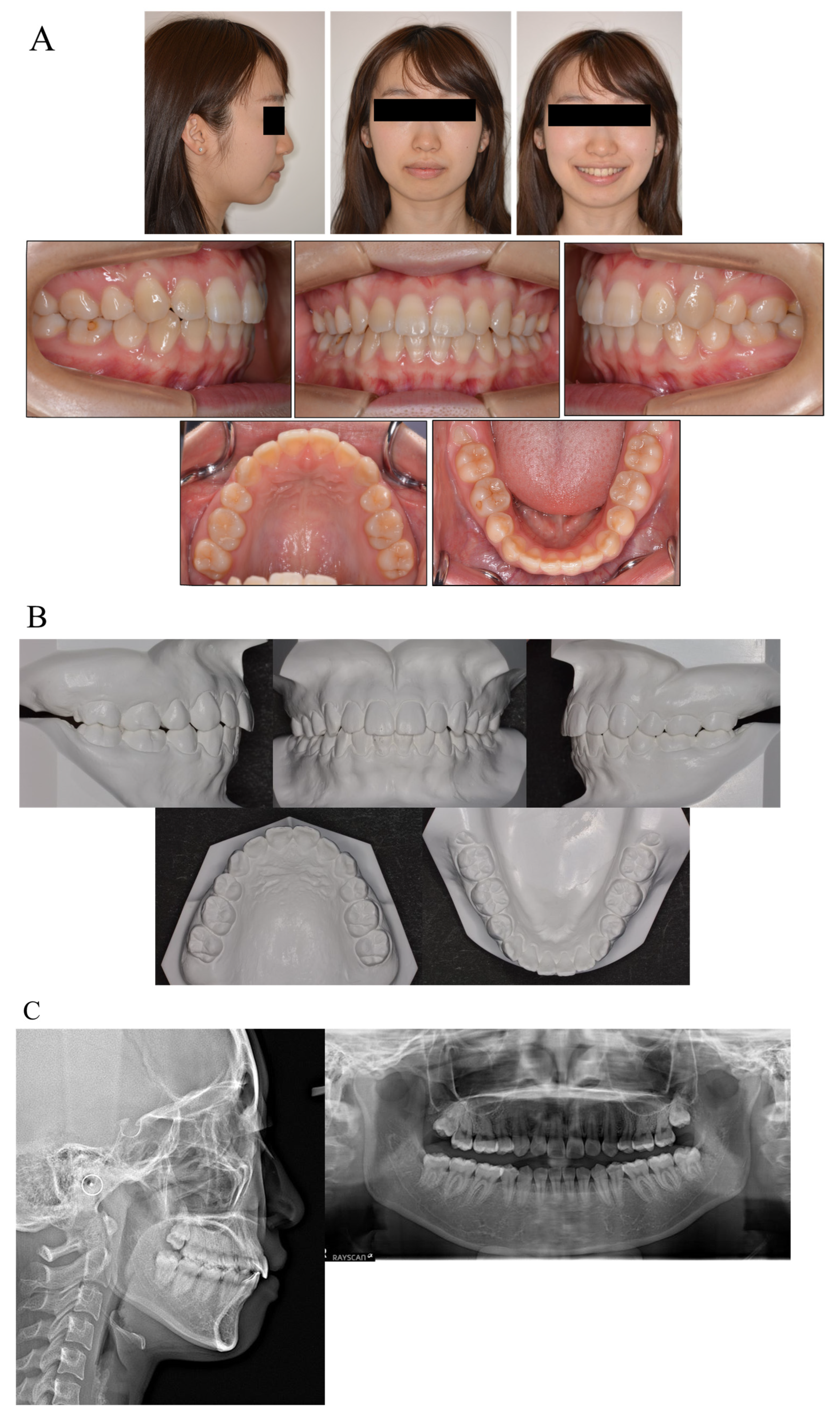 Medicina 58 00150 g004