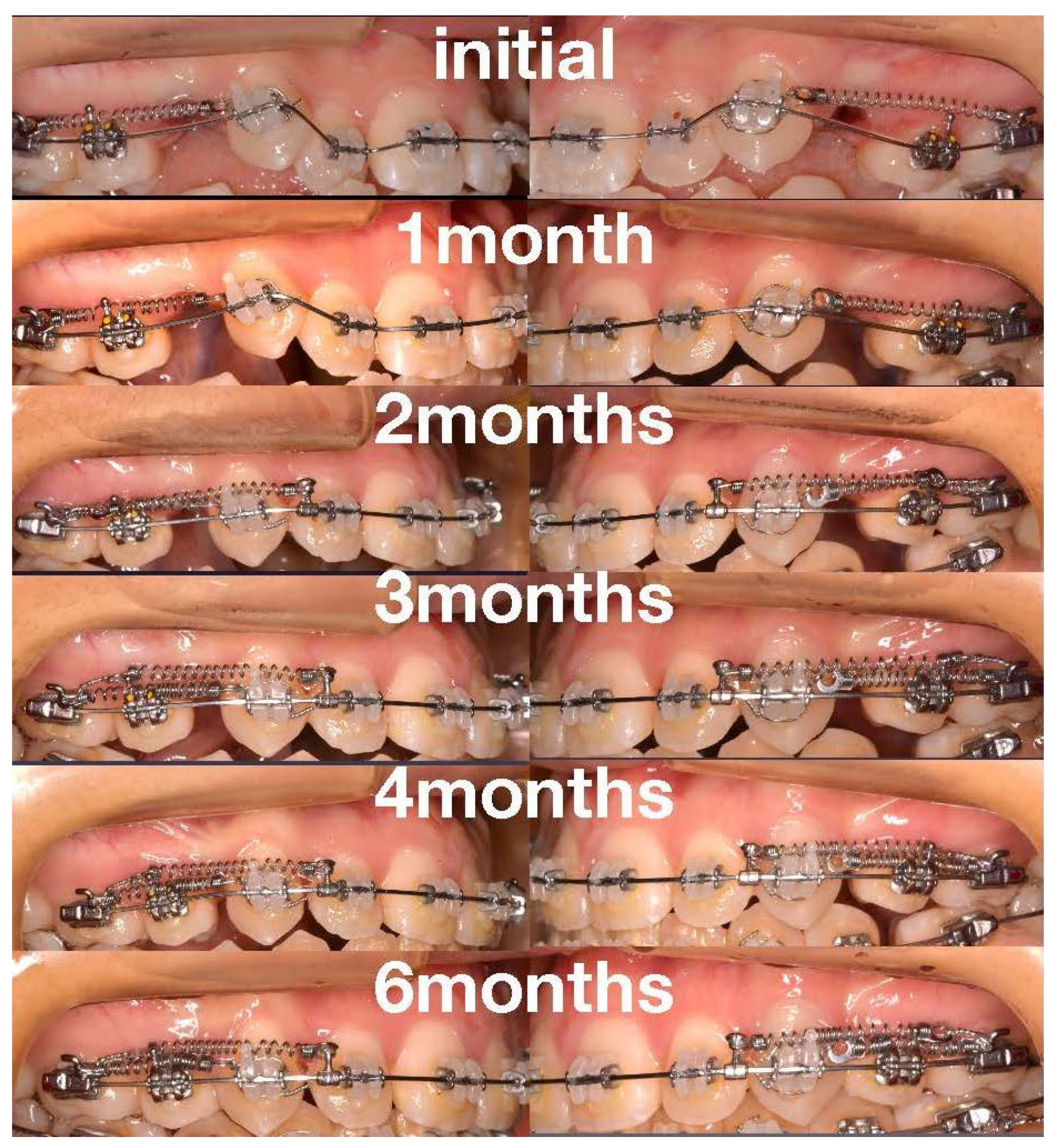 Medicina 58 00150 g006