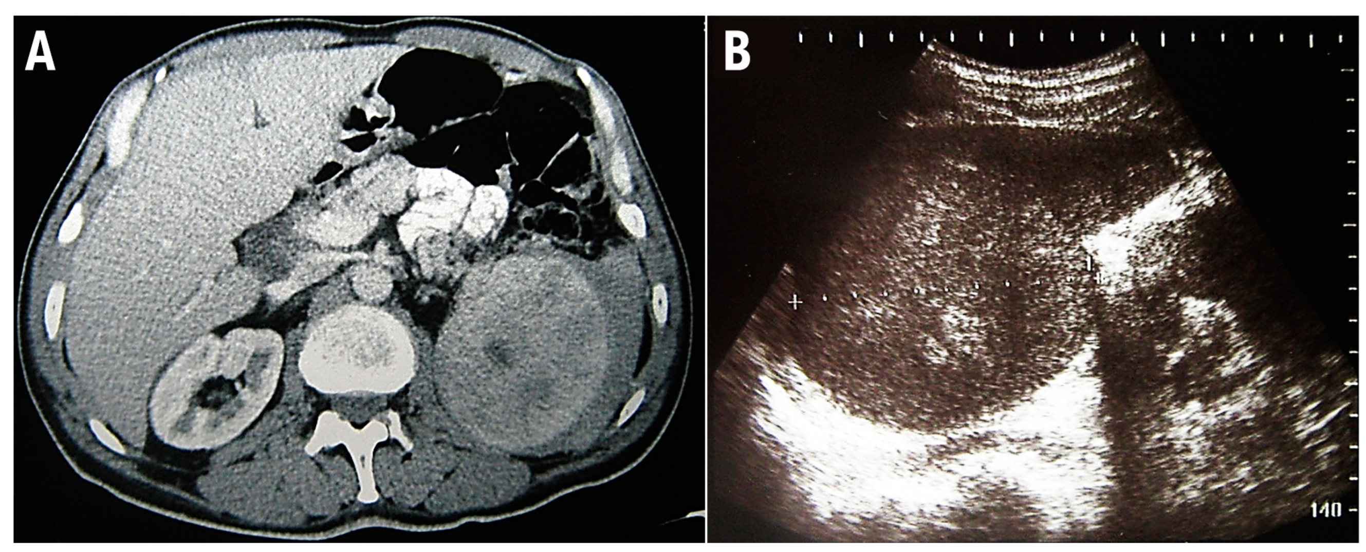 Medicina 58 00184 g002 Medicina 58 00184 g002