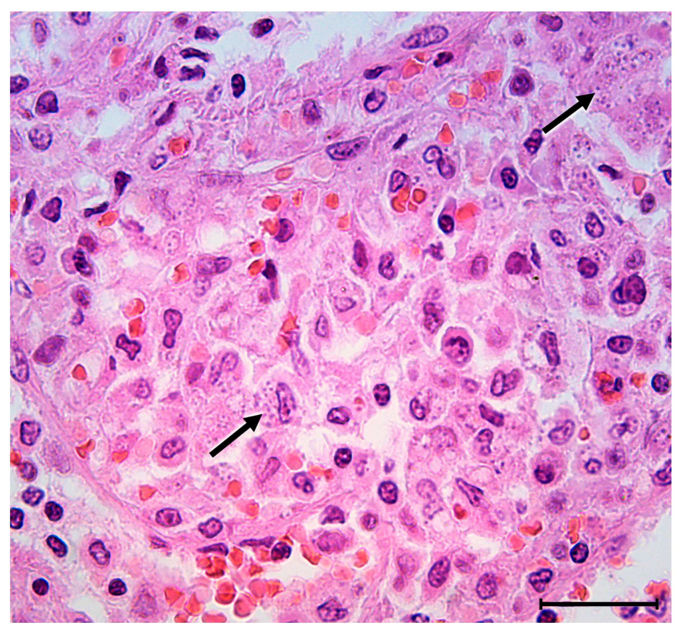 Medicina 58 00184 g004 Medicina 58 00184 g004