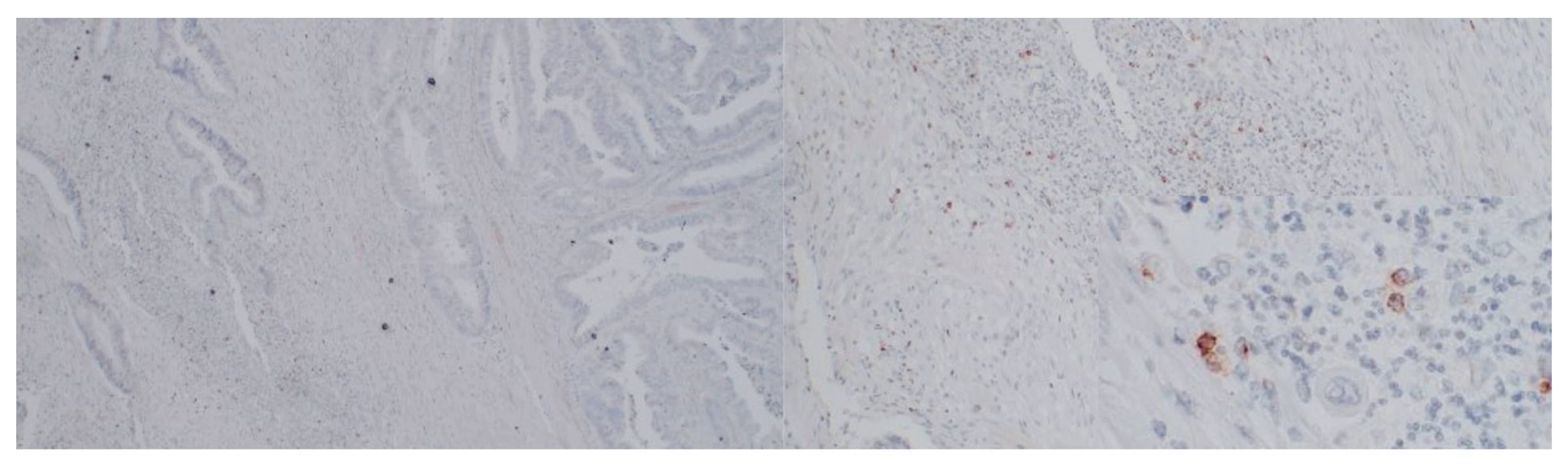 Medicina 58 00203 g004 Medicina 58 00203 g004