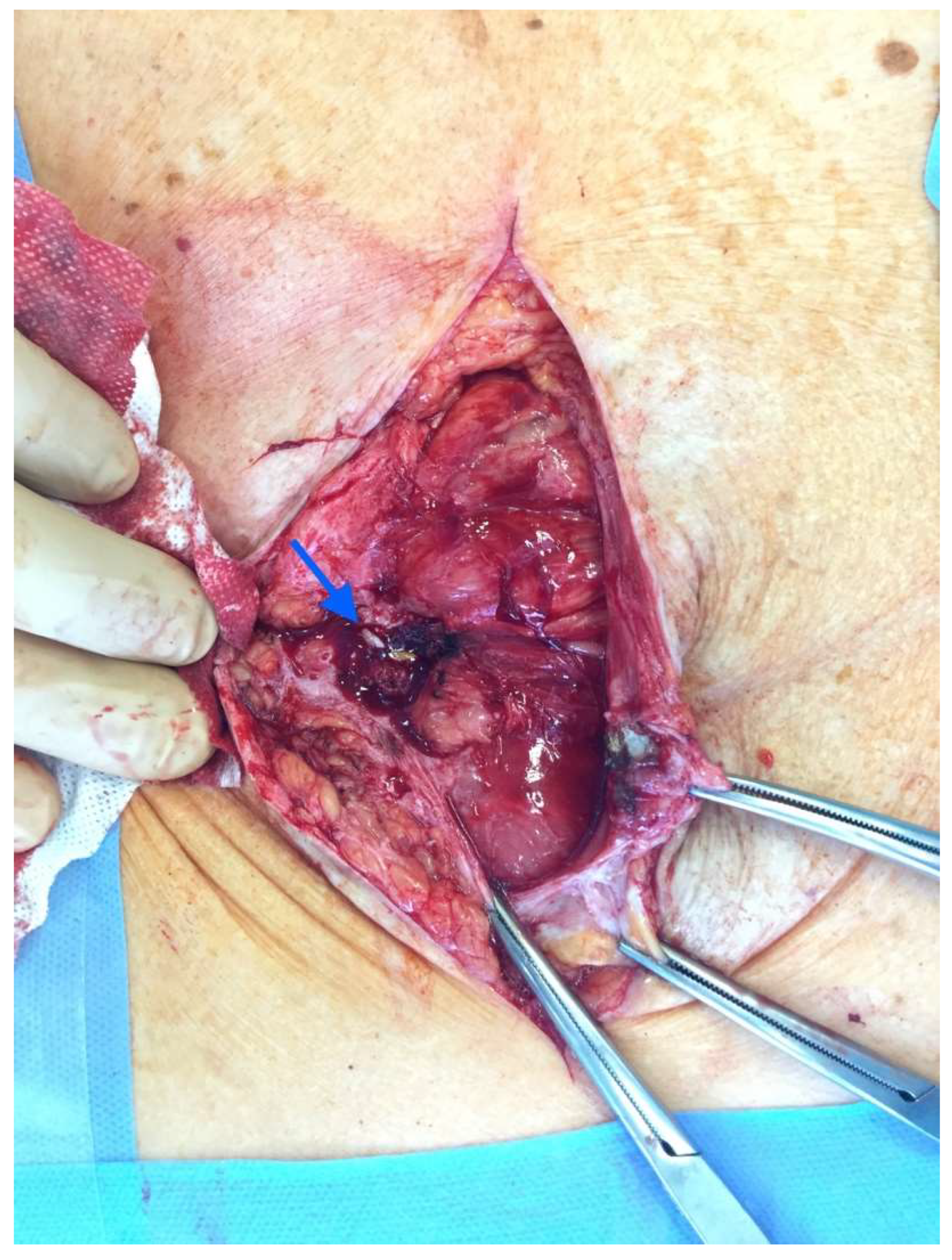 Medicina 58 00223 g002