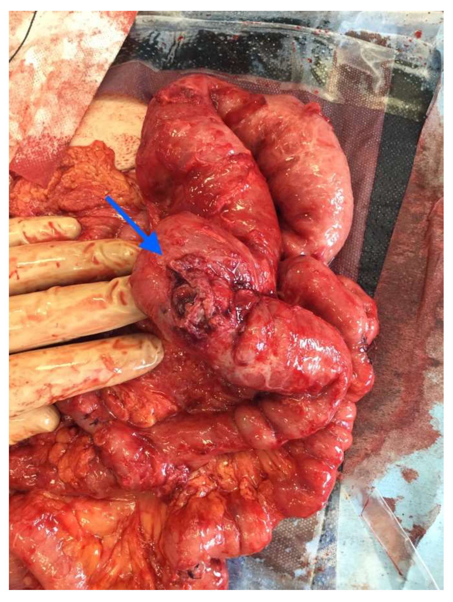 Medicina 58 00223 g003