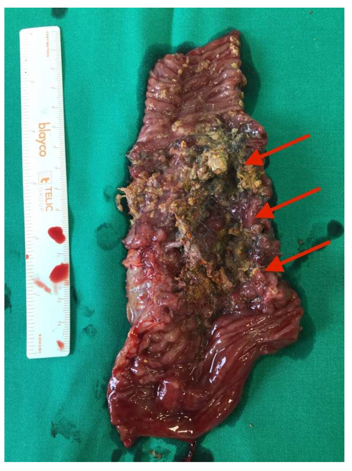 Medicina 58 00223 g004