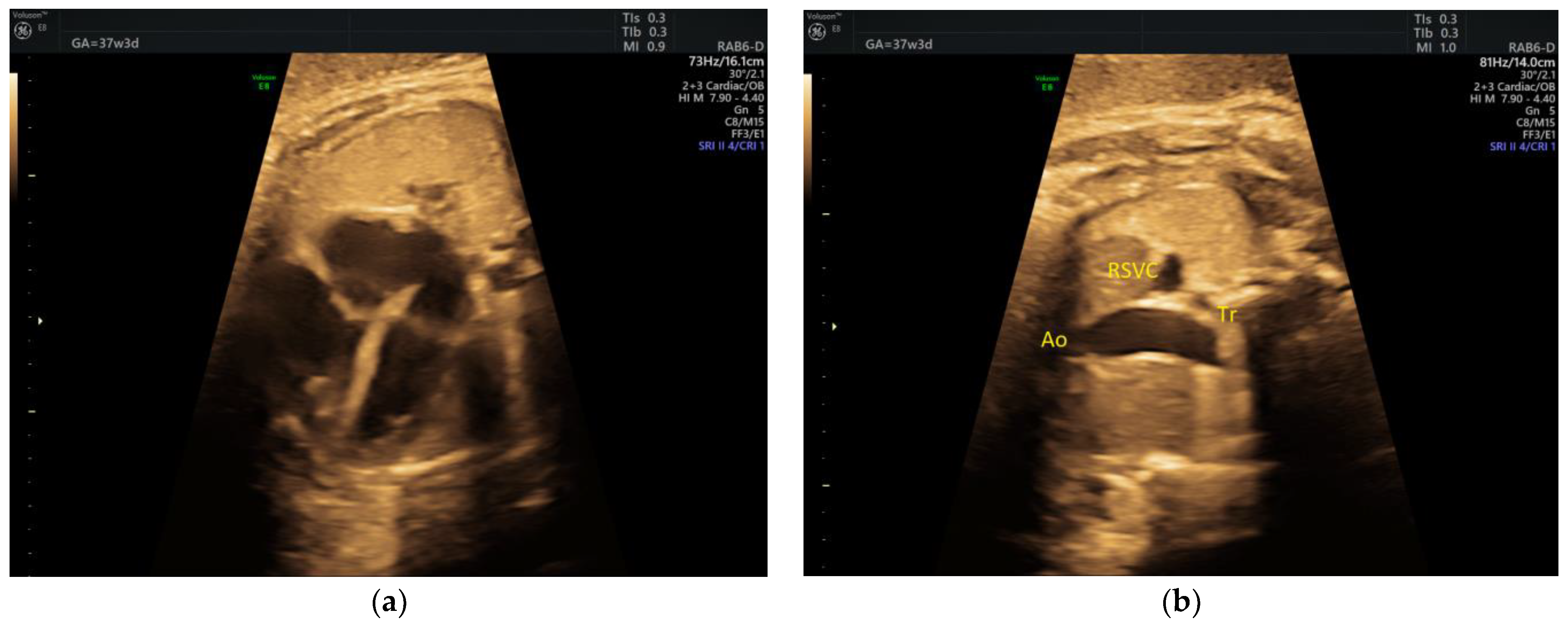 Medicina 58 00262 g001