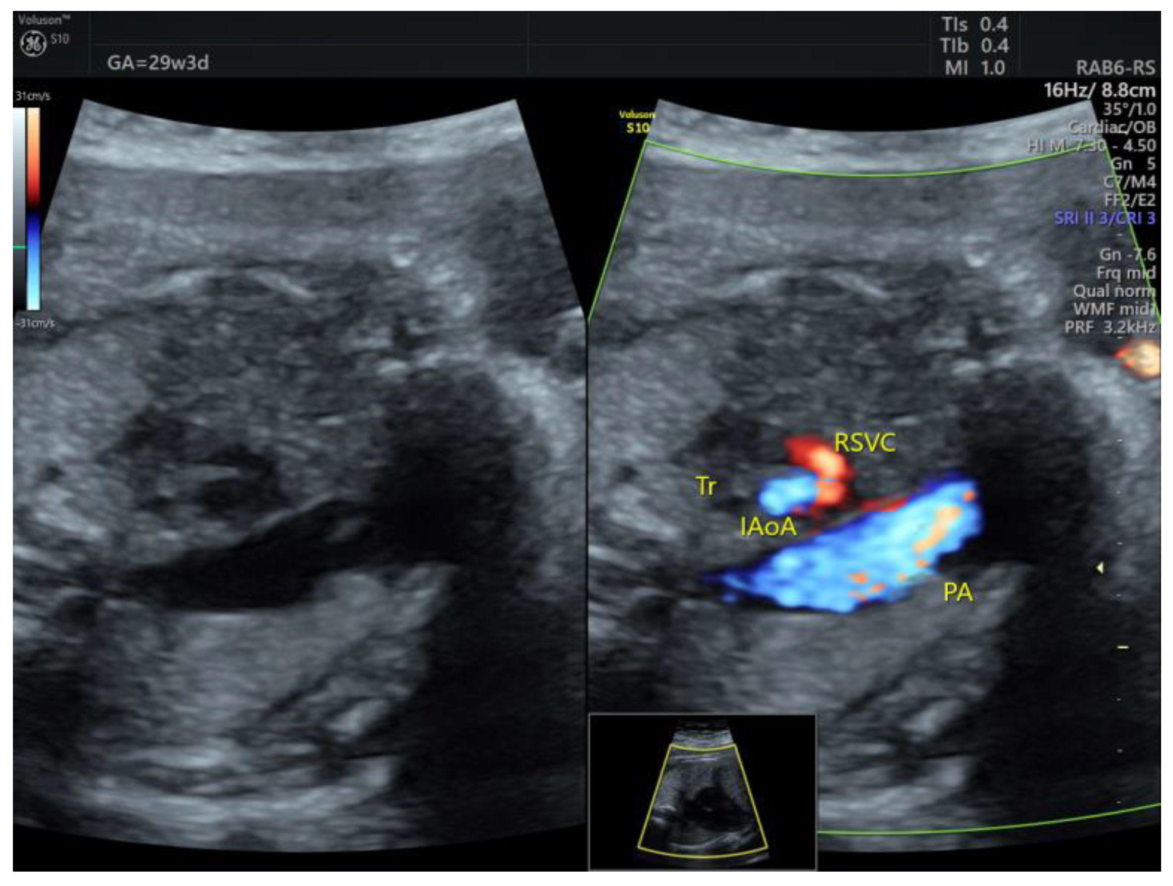 Medicina 58 00262 g002