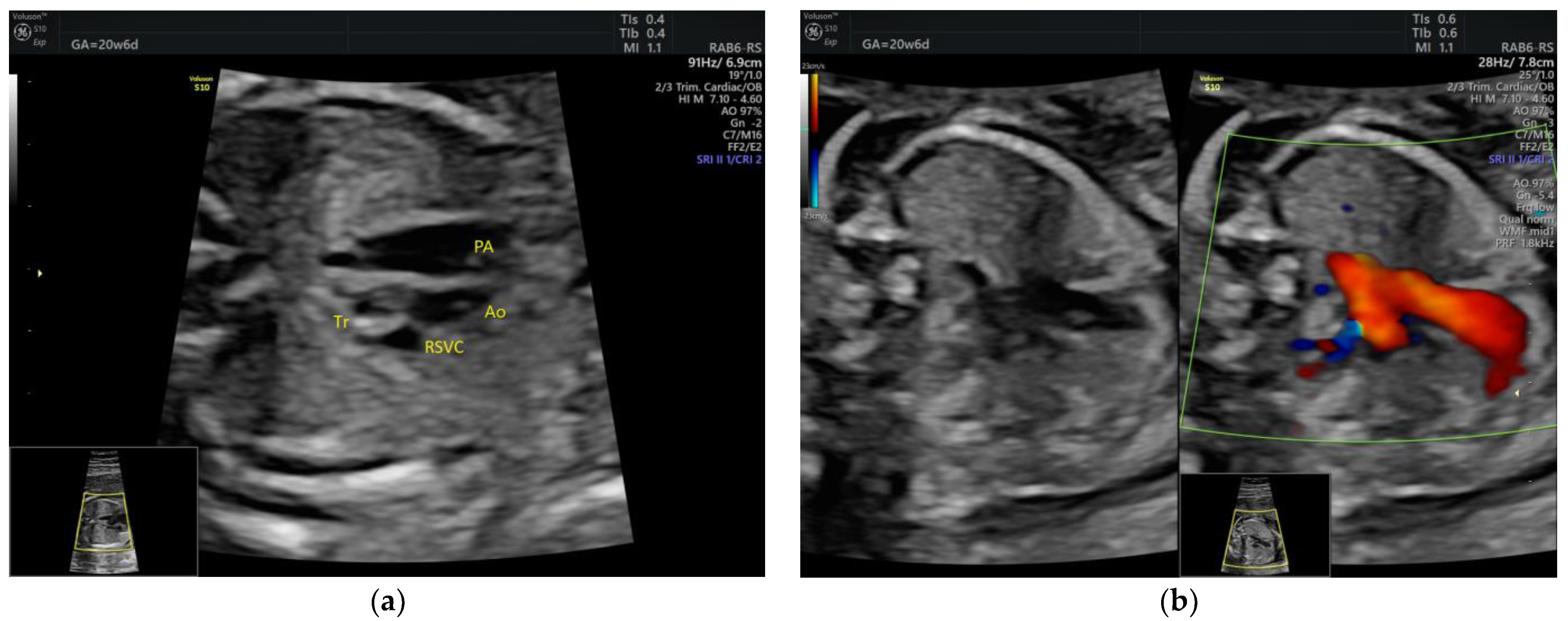 Medicina 58 00262 g004